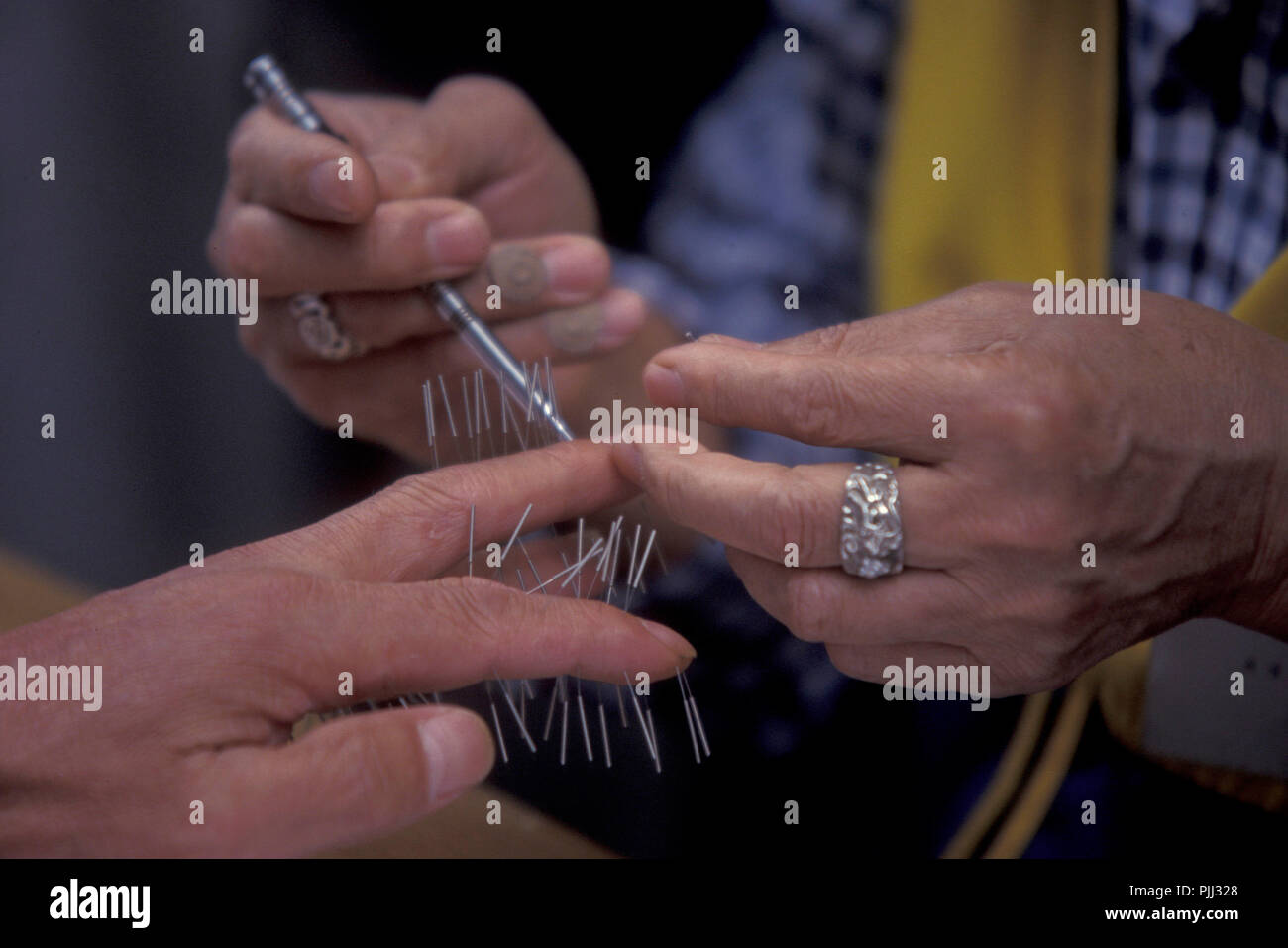 Acupuncture tradition hires stock photography and images Alamy