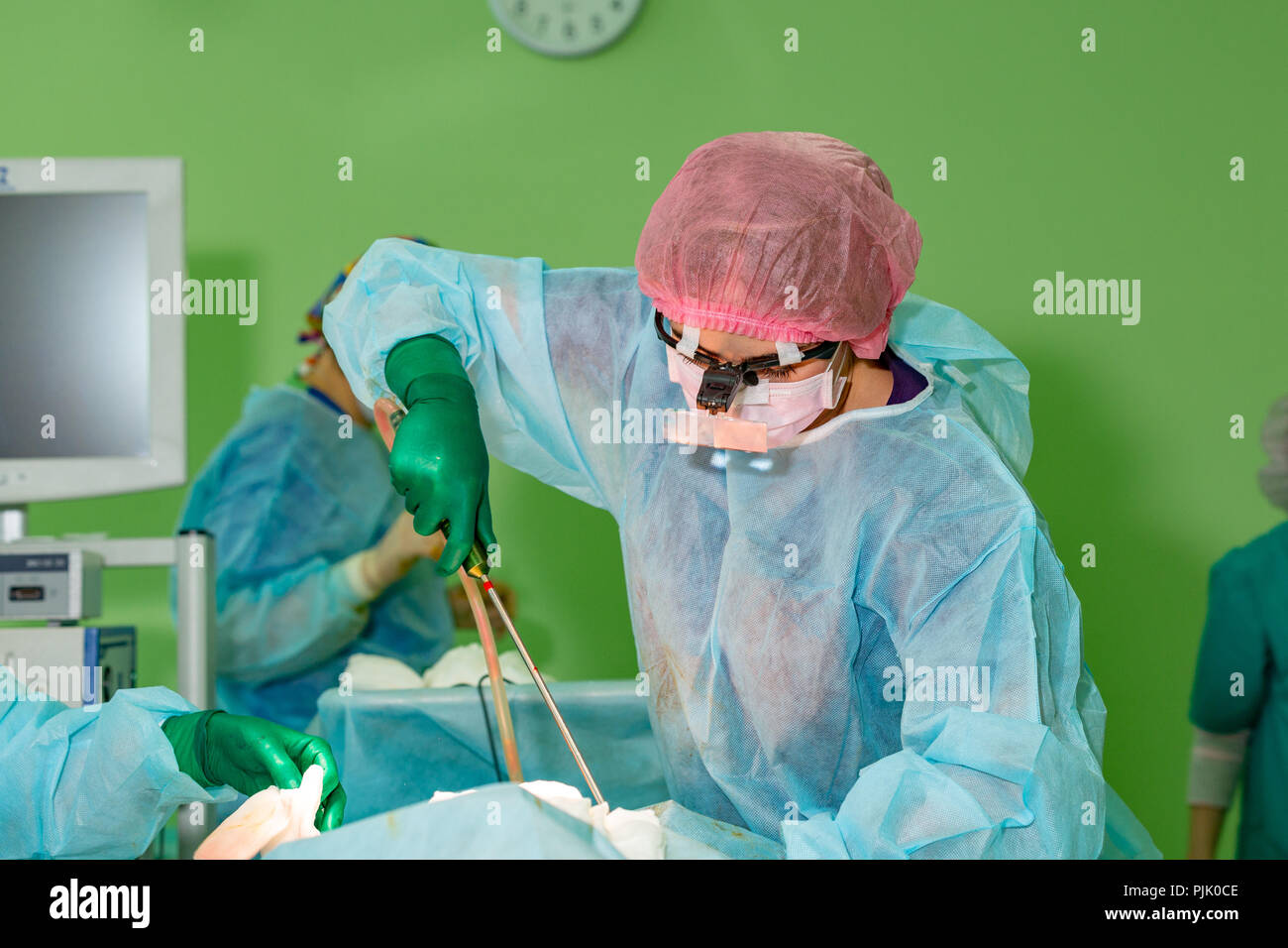 cosmetic liposuction surgery in actual operating room, group of