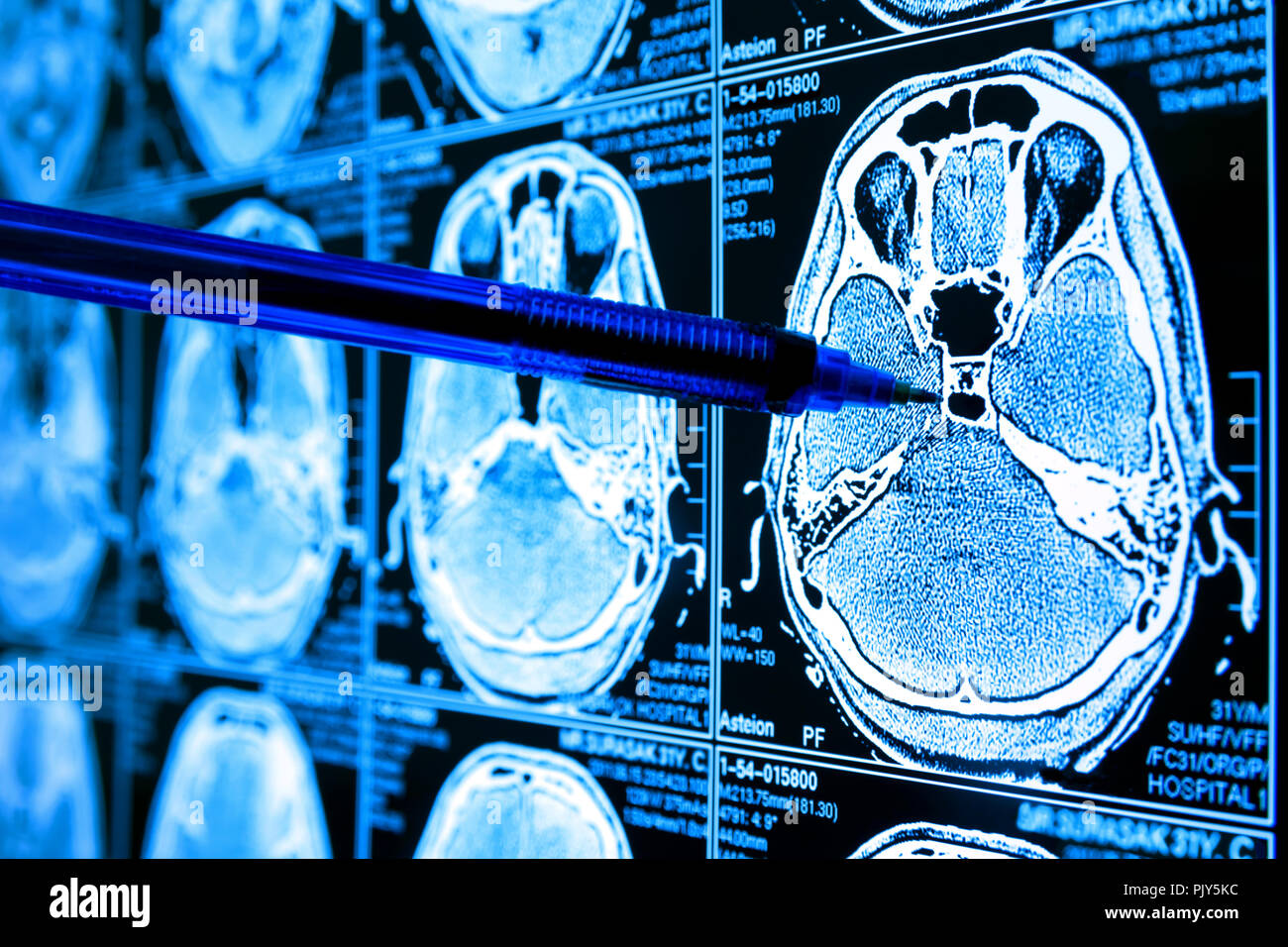 Artificial intelligence in smart healthcare hospital technology concept. Doctor point pen to AI biomedical algorithm screen and machine learning detec Stock Photo