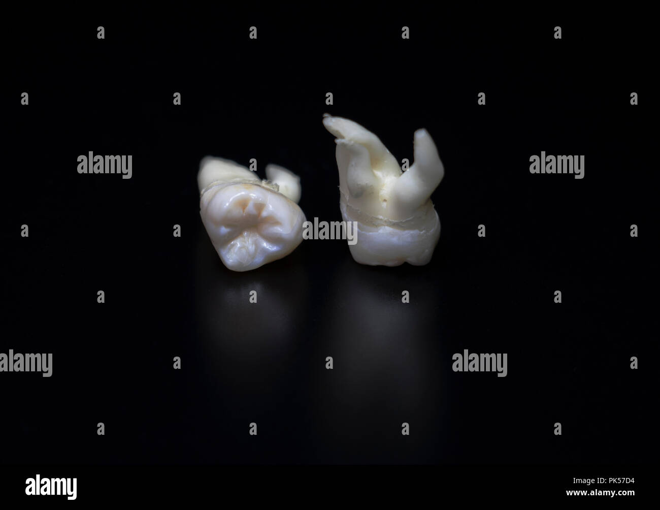 Human teeth. Extracted wisdom teeth isolated on black background. Set of white teeth. Stock Photo