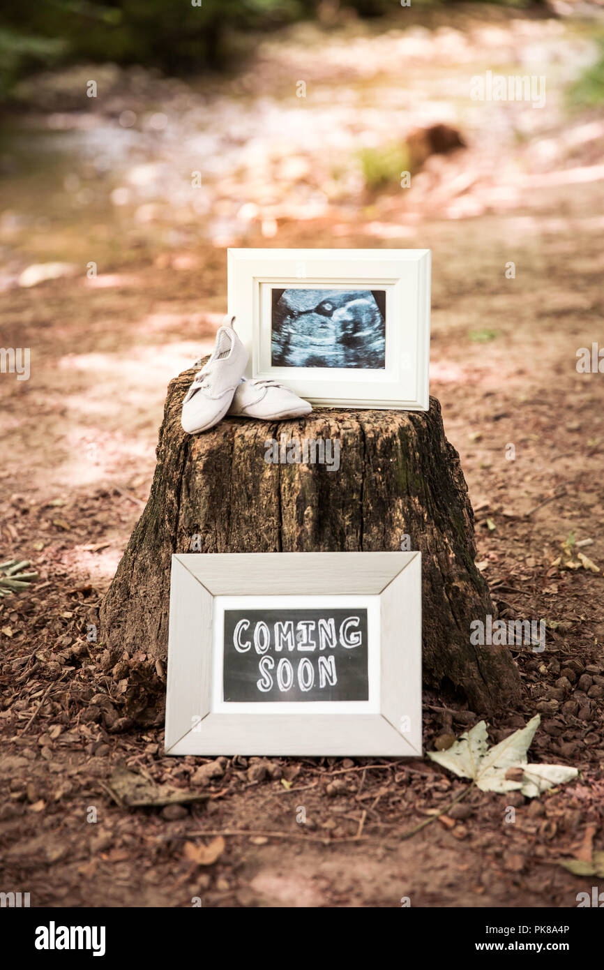 Coming Soon and Baby Ultrasound Photo Frames and Baby Shoes on Tree Trunk in Woods Stock Photo
