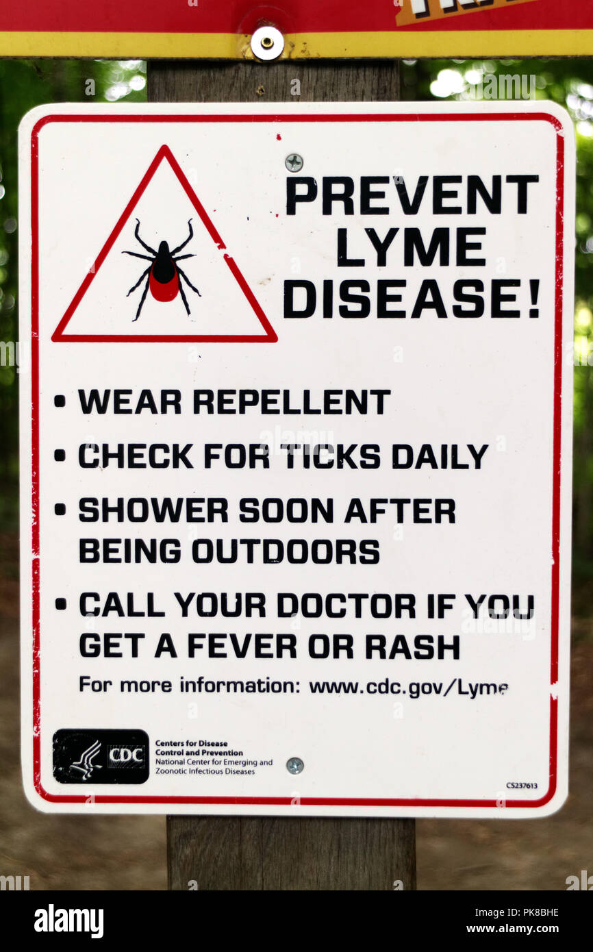 A sign in the woods at the Kingdom Trails mountain bike area warning of Lyme Disease from ticks Stock Photo