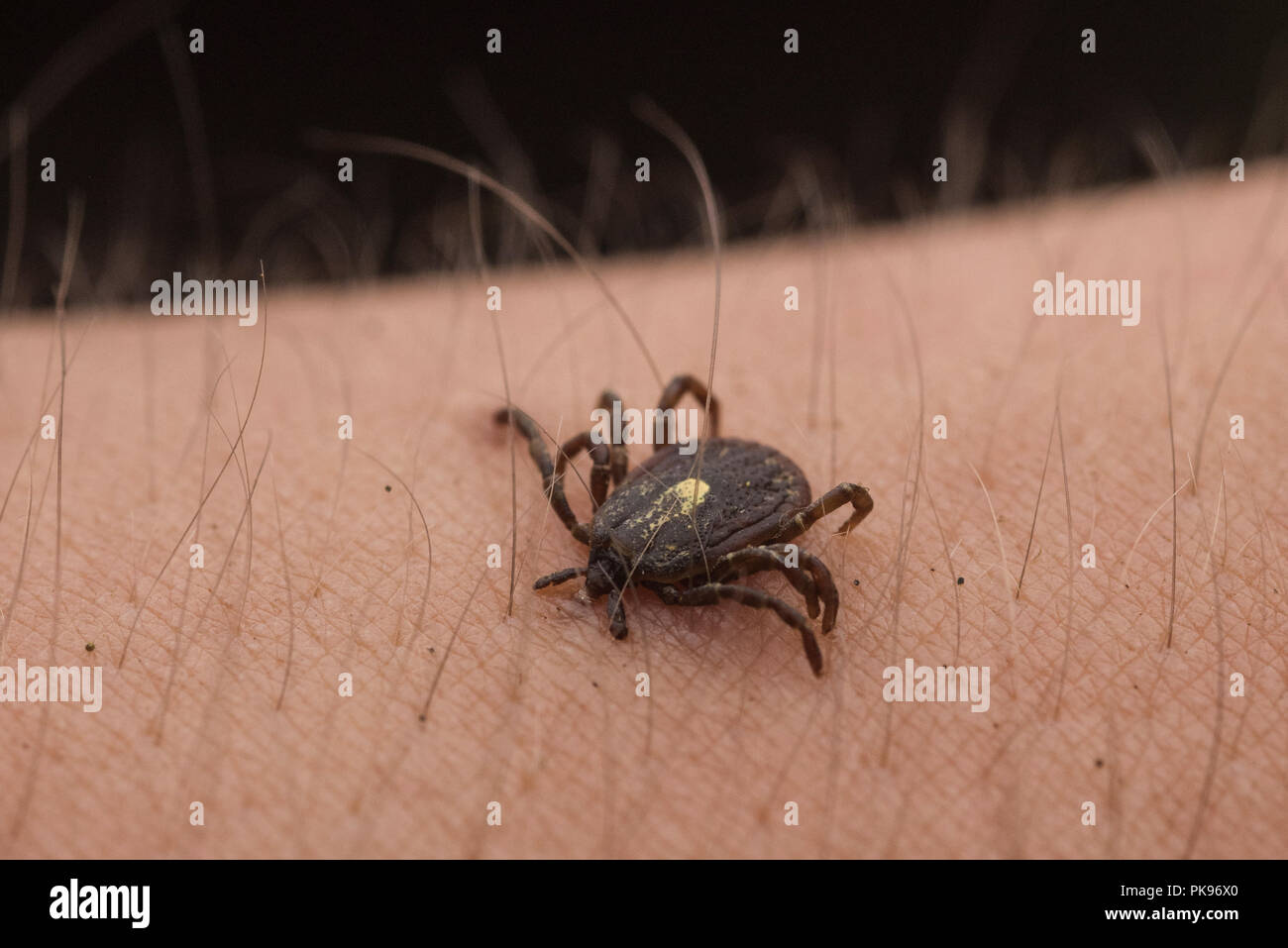 An embedded tick from Peru, ticks are a vectors of diseases which affect human health worldwide. Stock Photo