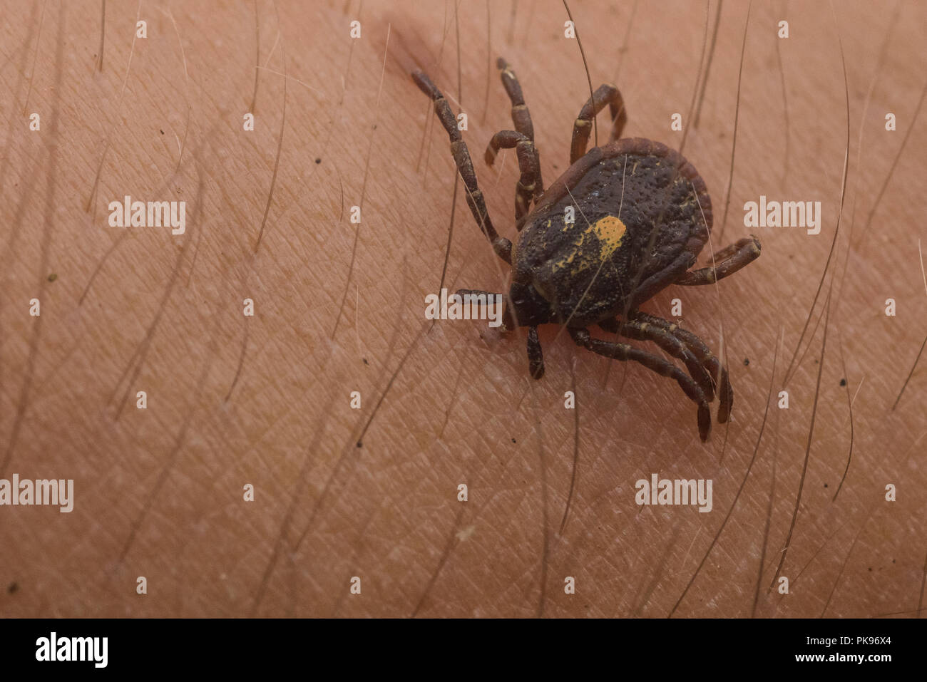 An embedded tick from Peru, ticks are a vectors of diseases which affect human health worldwide. Stock Photo