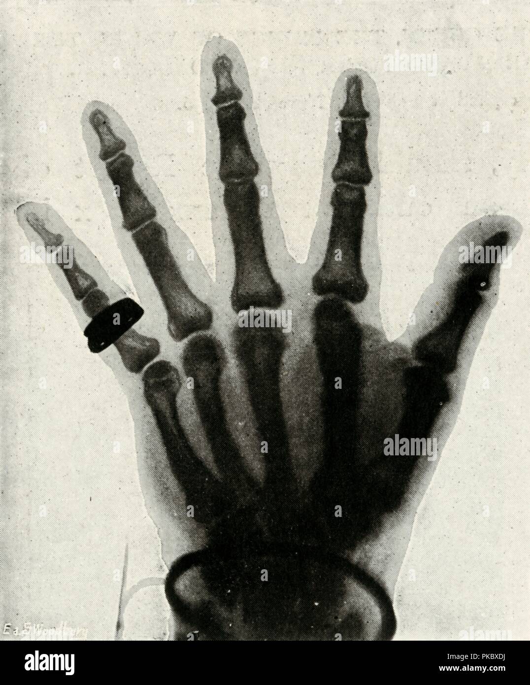 'Radiograph of the Hand of H.R.H. The Prince of Wales', (c1897). Artist: Unknown. Stock Photo