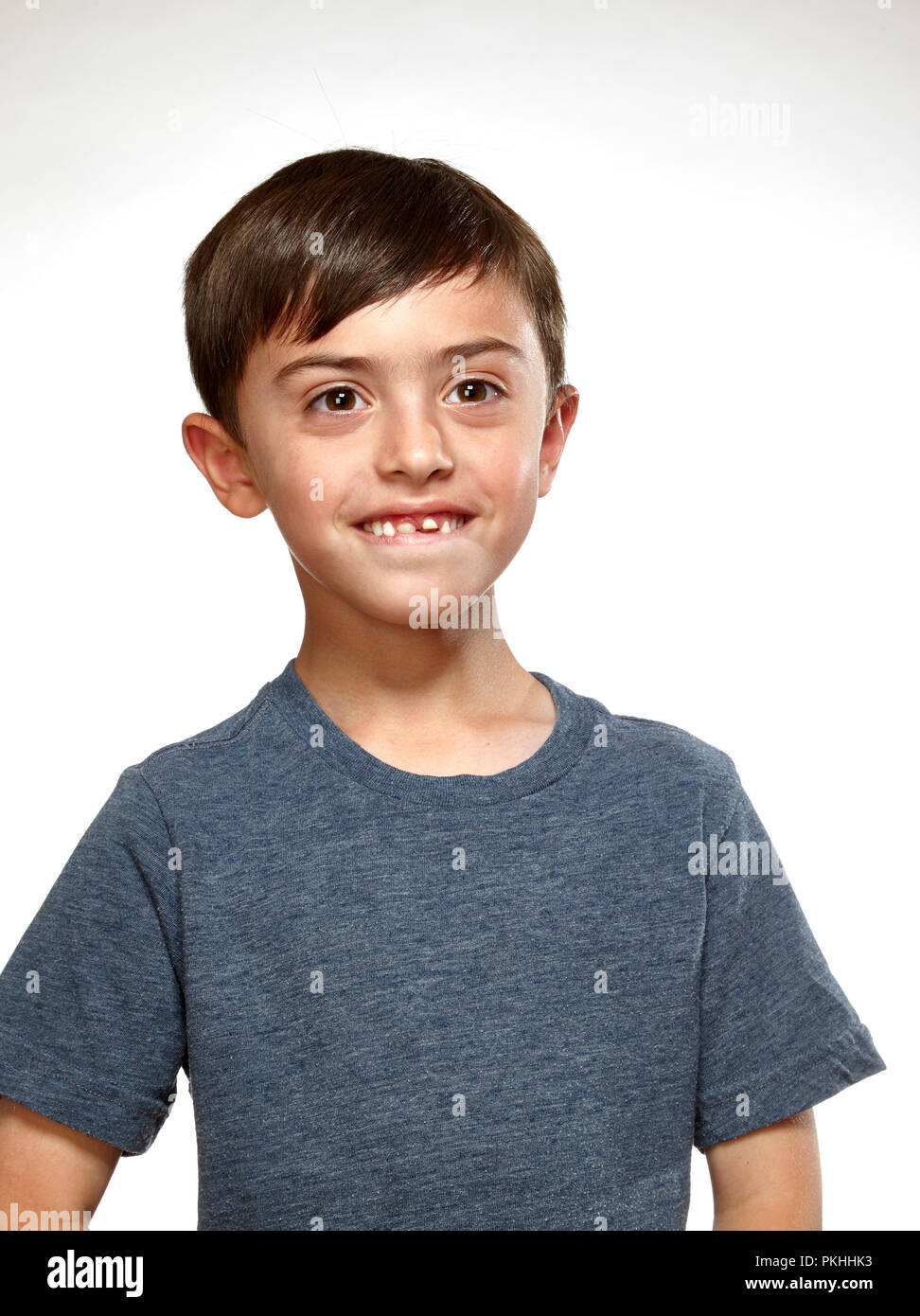 young boy with bad teeth Stock Photo