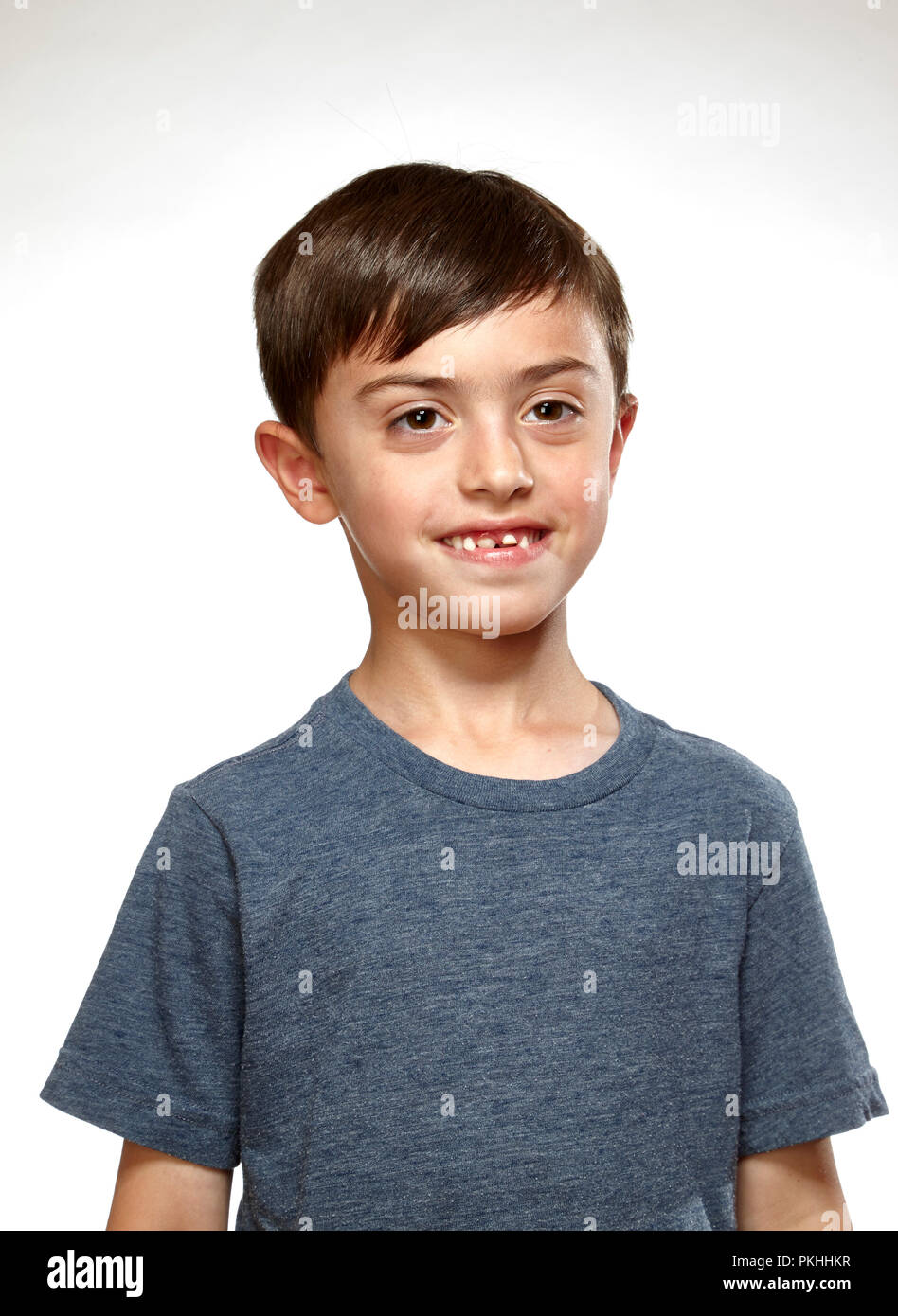 young boy with bad teeth Stock Photo - Alamy