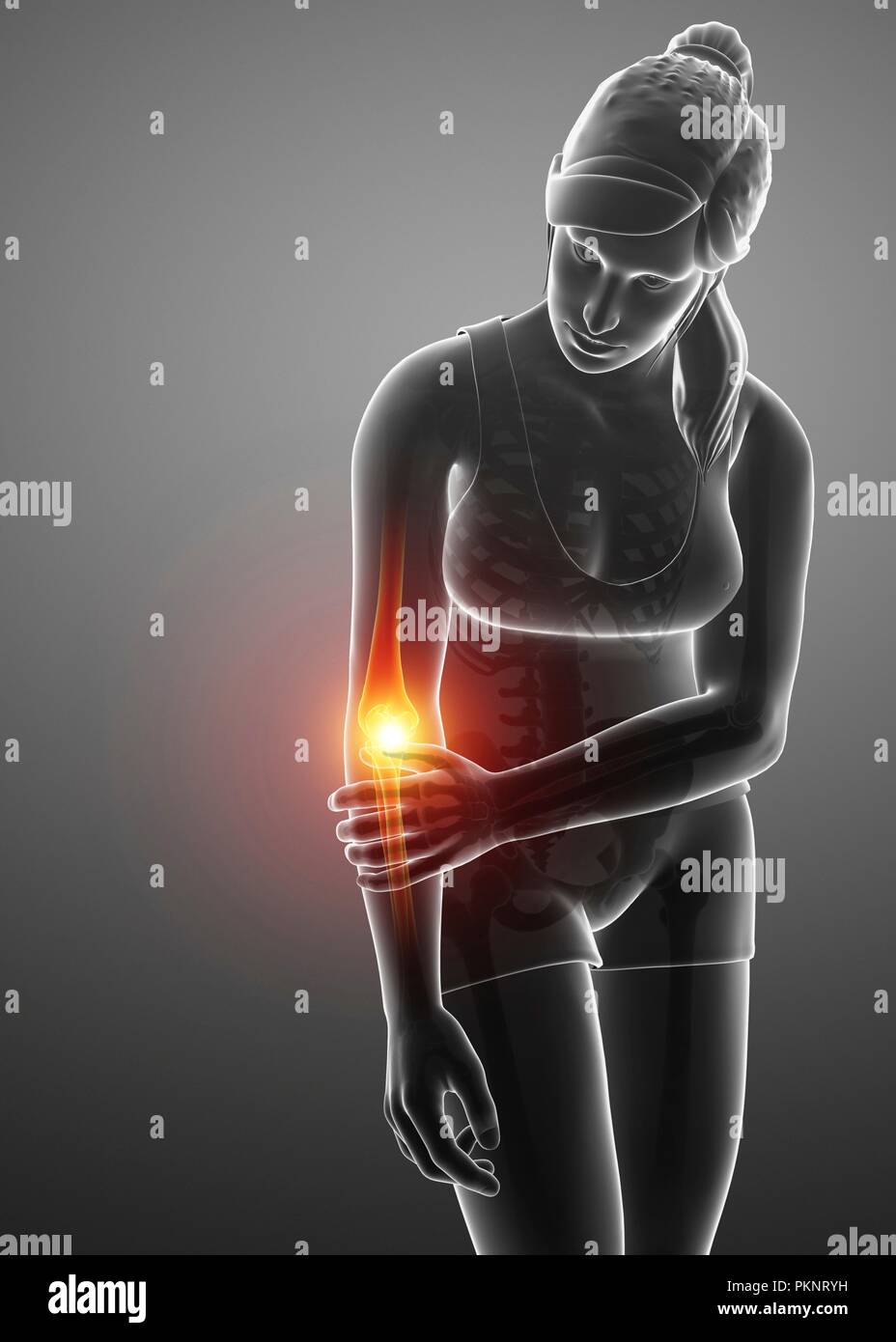 Woman with elbow pain, computer illustration Stock Photo Alamy