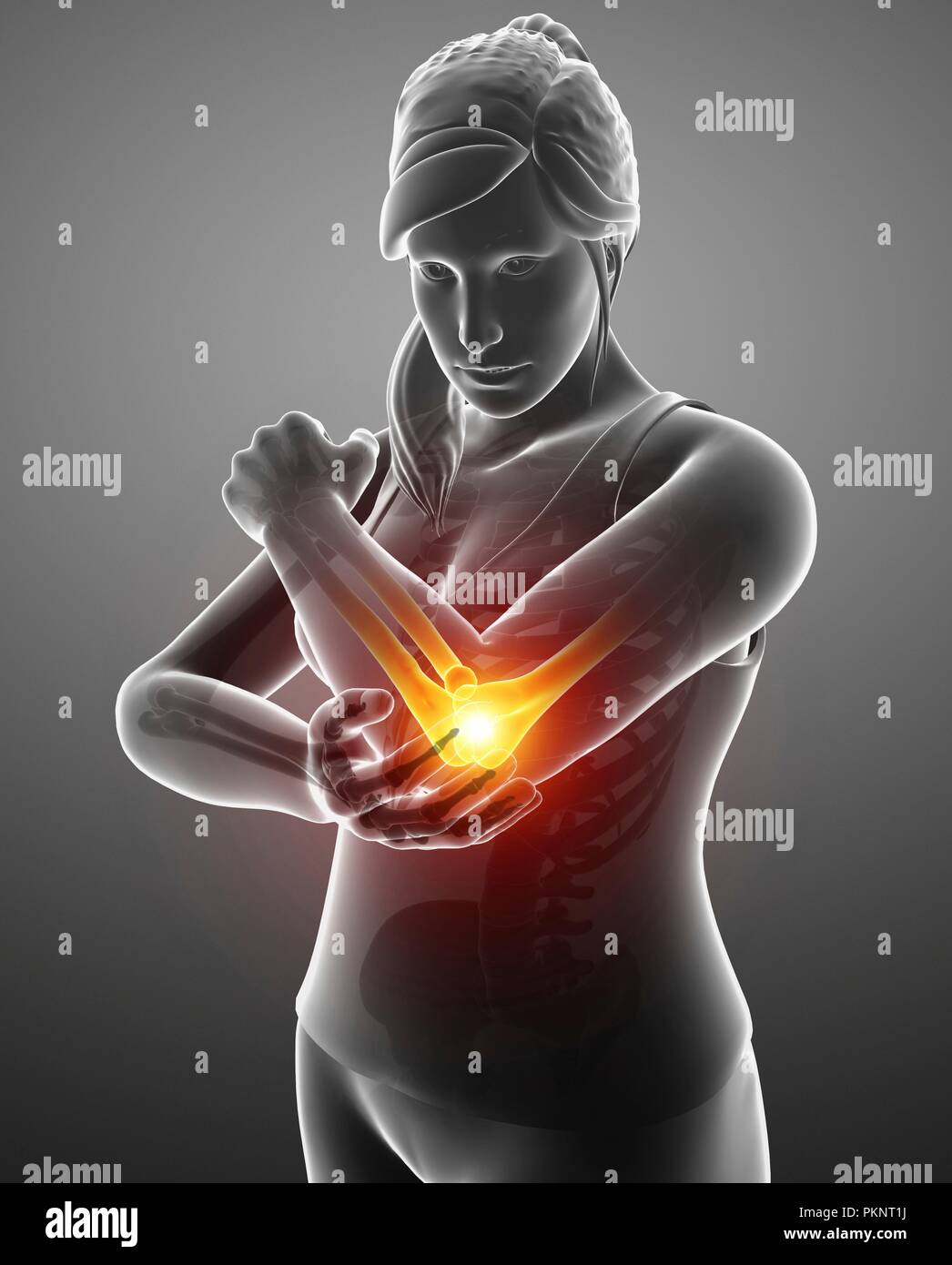 Woman with elbow pain, computer illustration Stock Photo - Alamy
