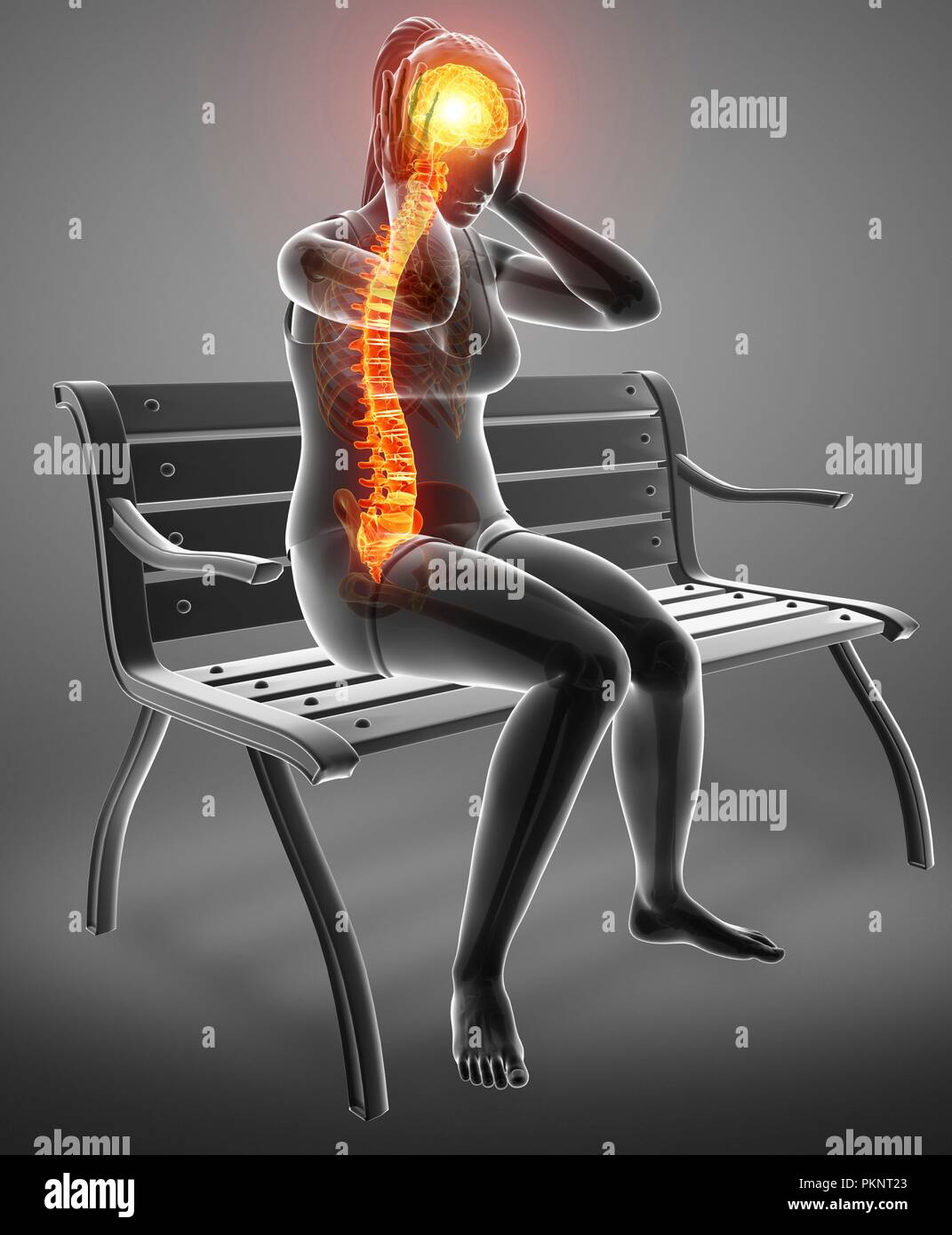 Woman with back pain, computer illustration. Stock Photo