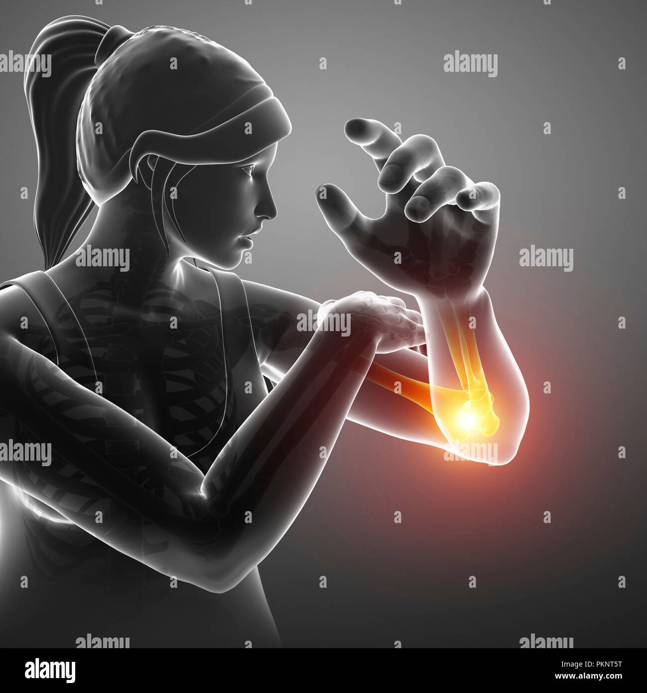 Woman with elbow pain, computer illustration Stock Photo Alamy