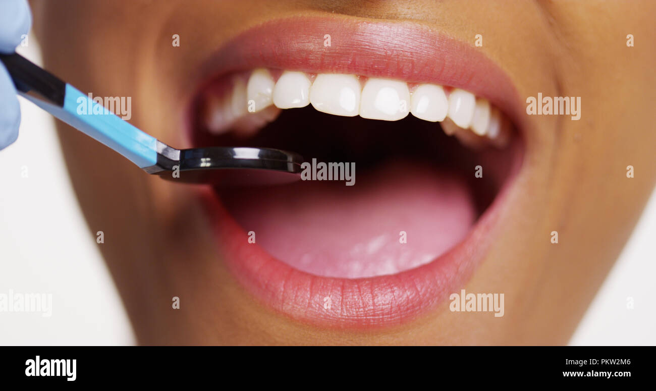 Smiling mouth clean teeth hi-res stock photography and images - Alamy