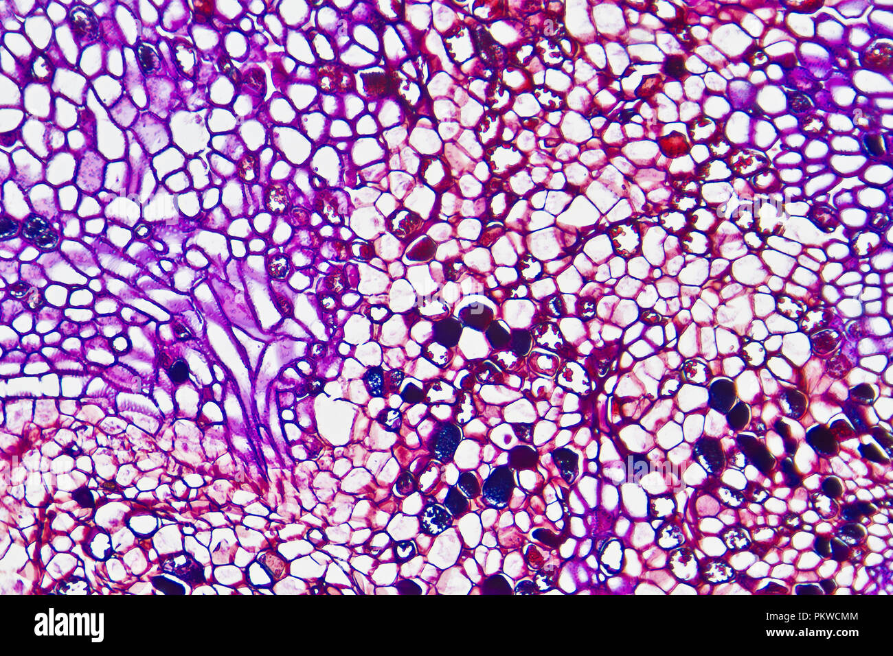 Micro photo of Crown gall, plant disease, caused by the bacterium Agrobacterium tumefaciens.(Rhizobium radiobacte) Stock Photo