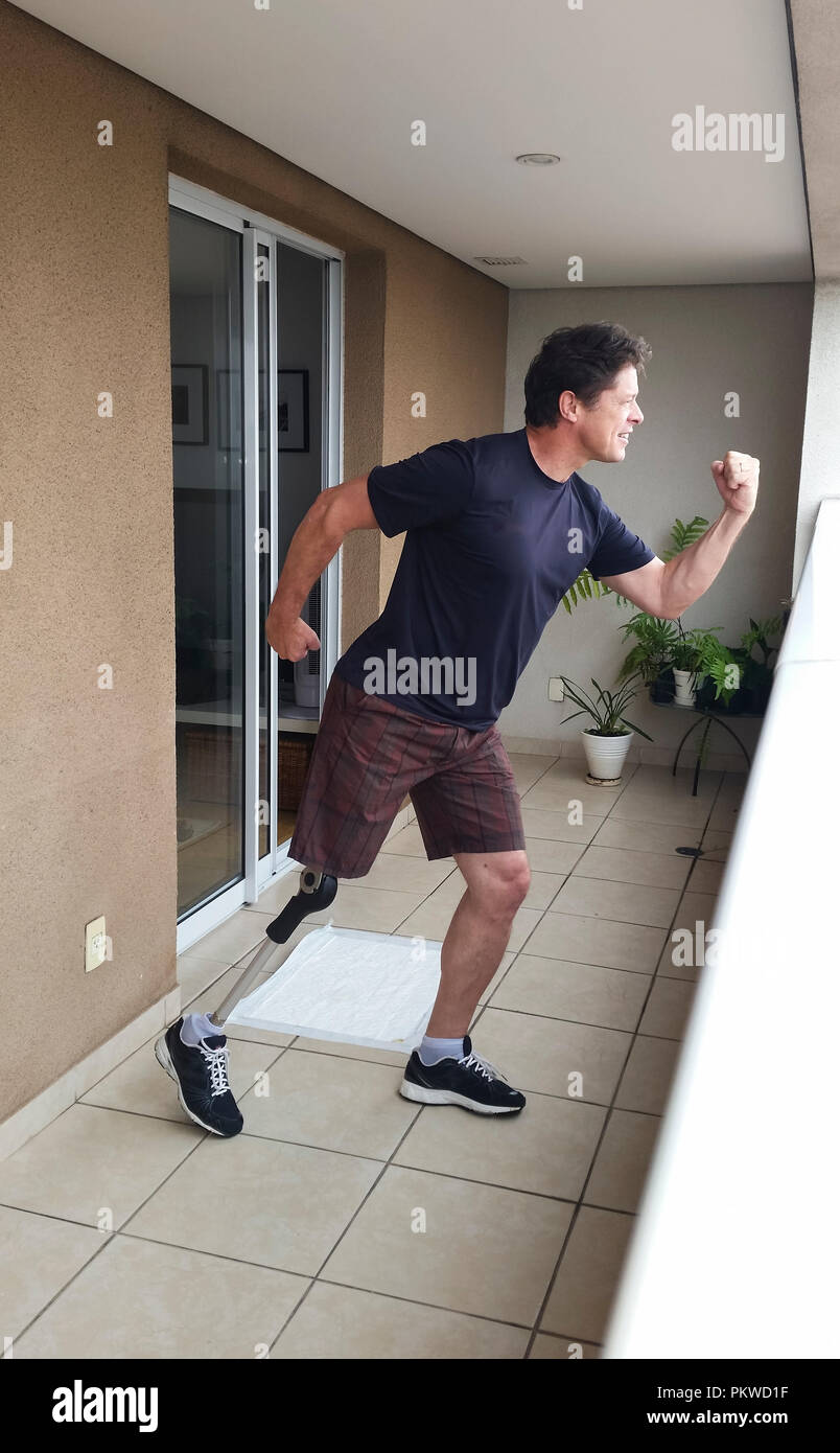 Man amputated, standing with prosthetic leg. Stock Photo
