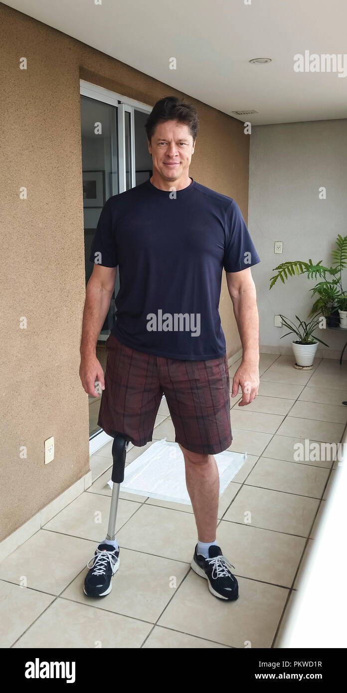 Man amputated, standing with prosthetic leg. Stock Photo