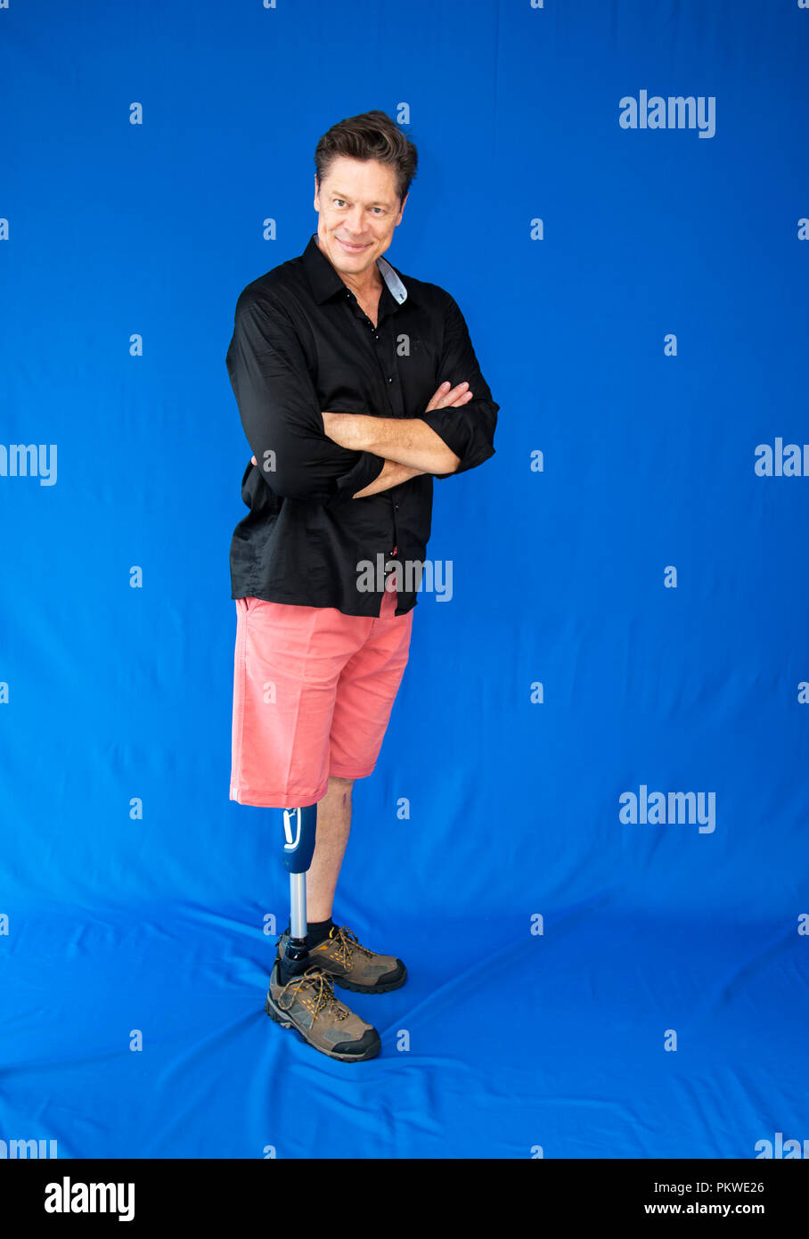 Middle-aged man with physical, leaning on his prosthesis. Stock Photo