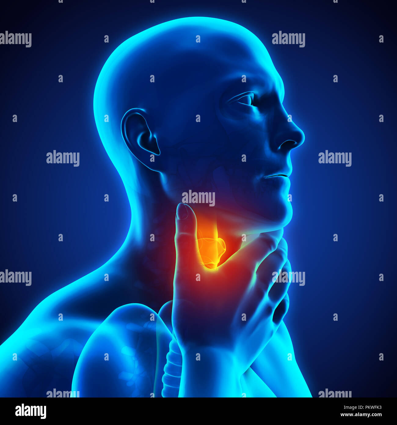 Sore Throat Illustration Stock Photo Alamy