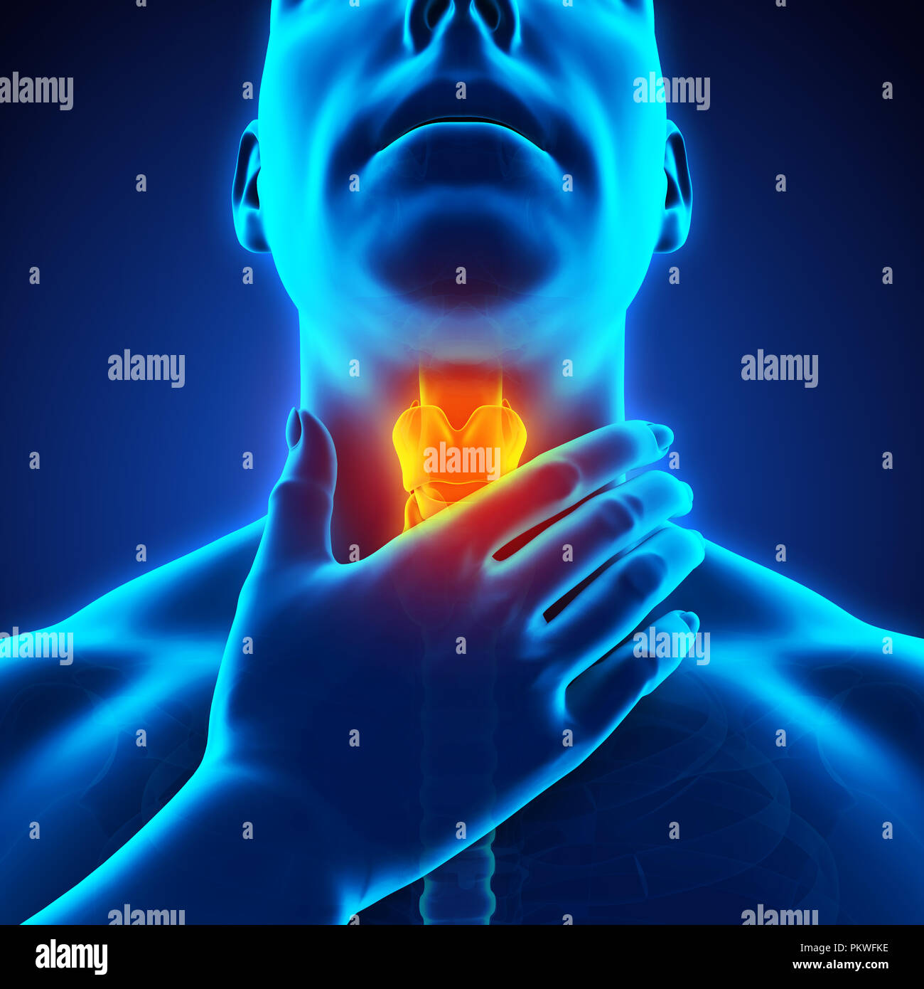 болит шея грипп