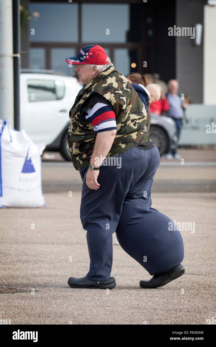 man aged elderly healthcare health leg ulcer weight overweight obesity