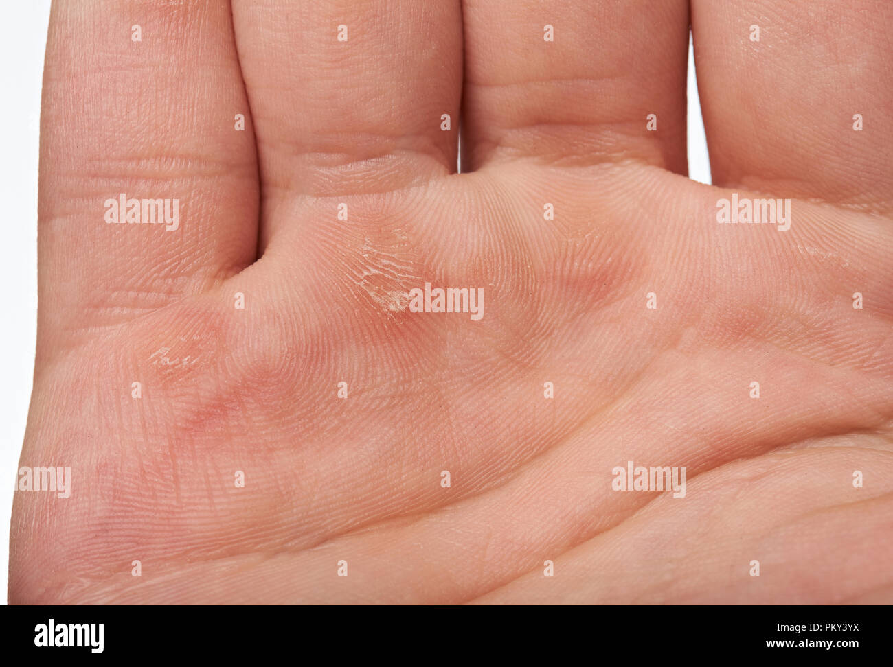 Two hands palm with blister Stock Photo by ©dimarik 215741652