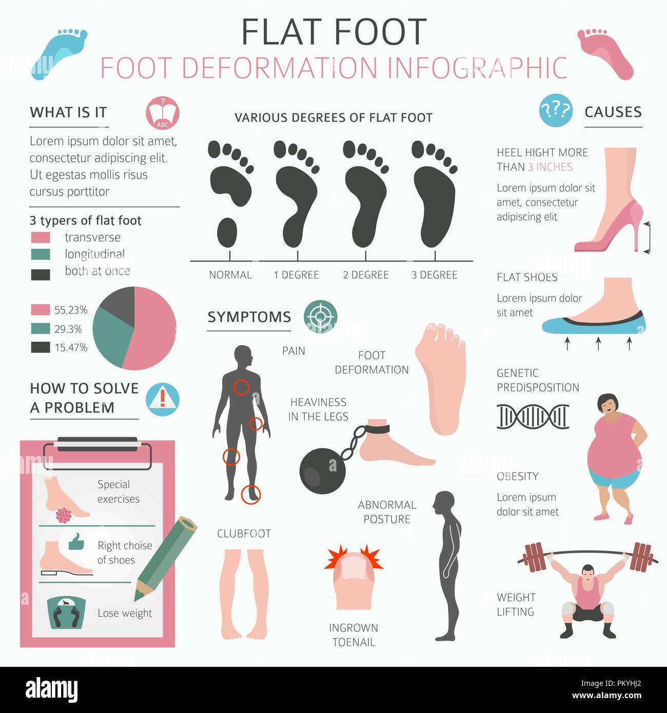 Flat foot hi res stock photography and images Alamy
