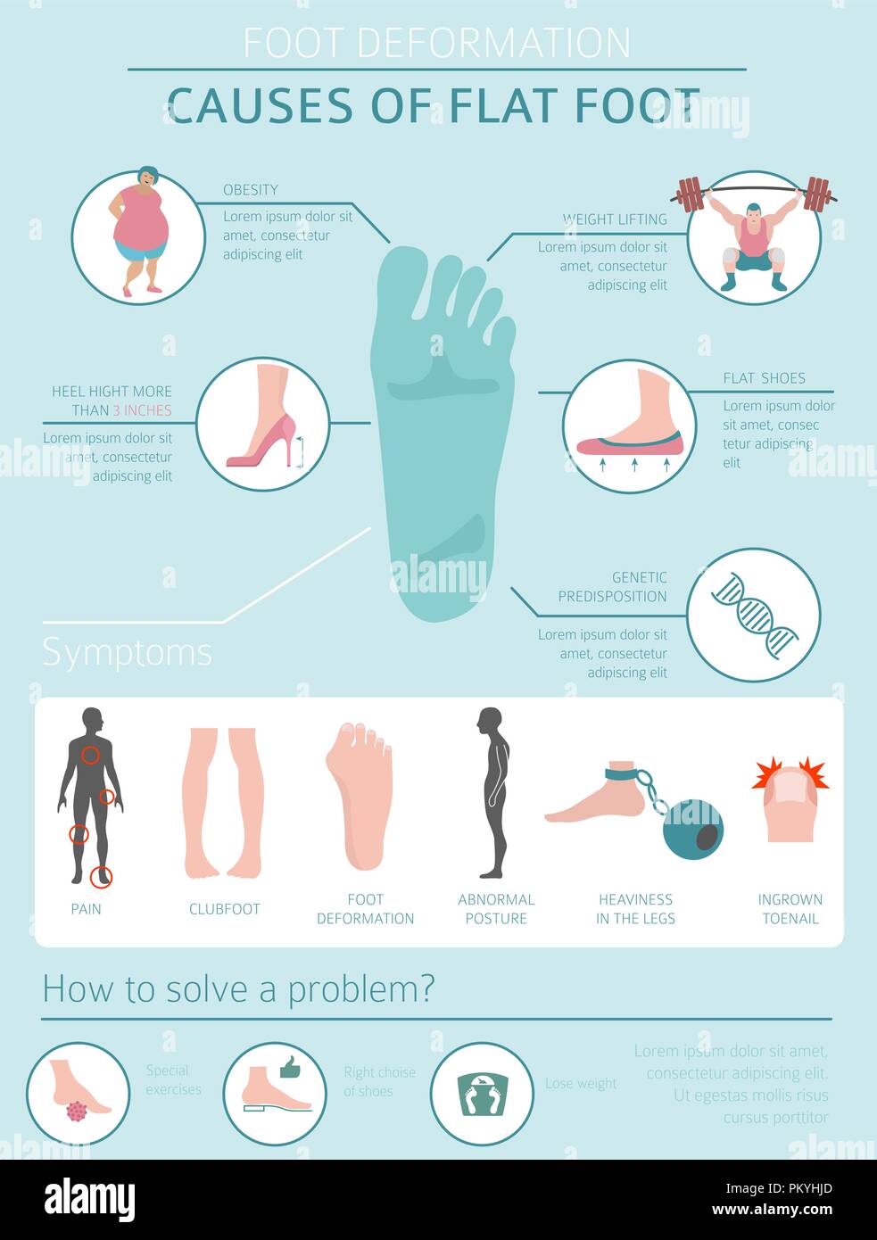 Foot Deformation As Medical Desease Infographic Causes Of Flat Foot Vector Illustration Stock Vector Image Art Alamy Foot Deformation As Medical Desease Infographic Causes Of Flat Foot Vector Illustration Stock Vector Image Art Alamy