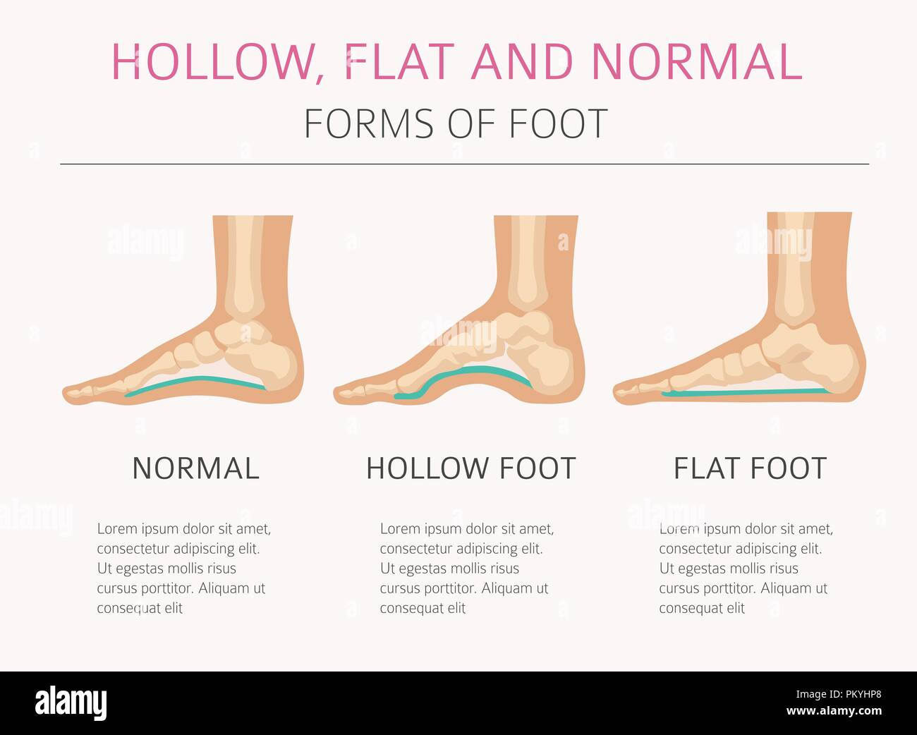 Normal foot hi-res stock photography and images - Alamy