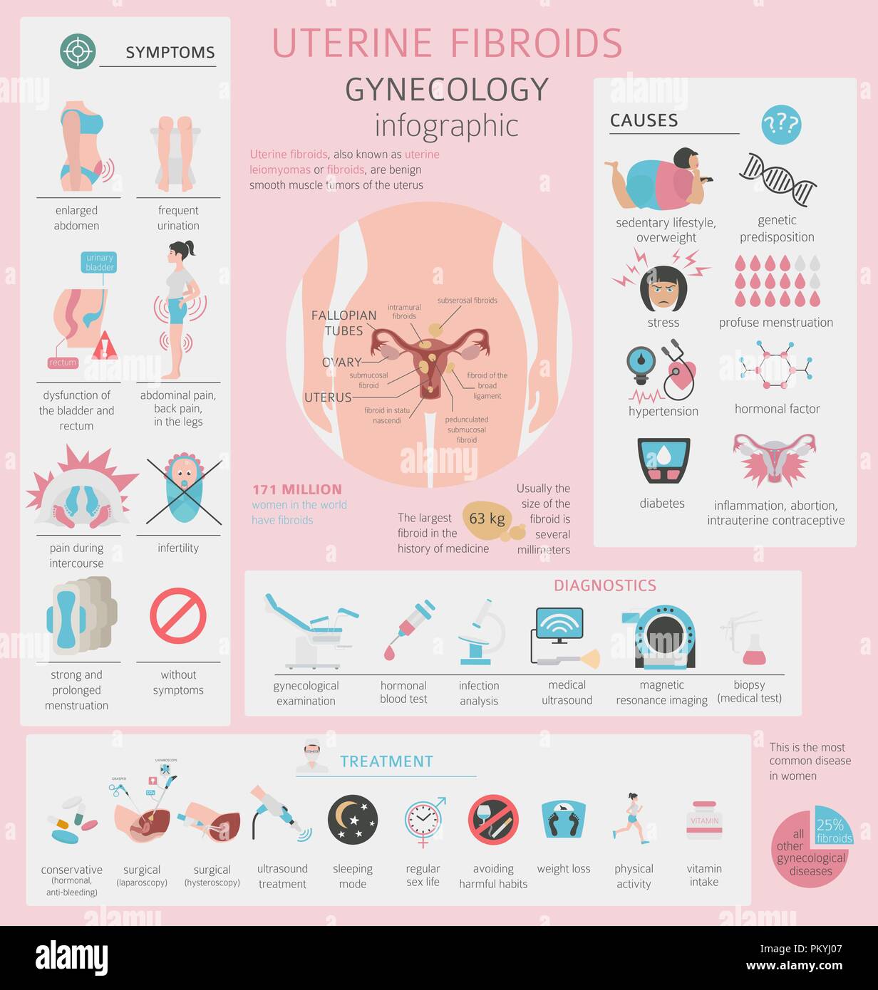 Uterine fibroids. Ginecological medical desease in women infographic. Vector illustration Stock Vector