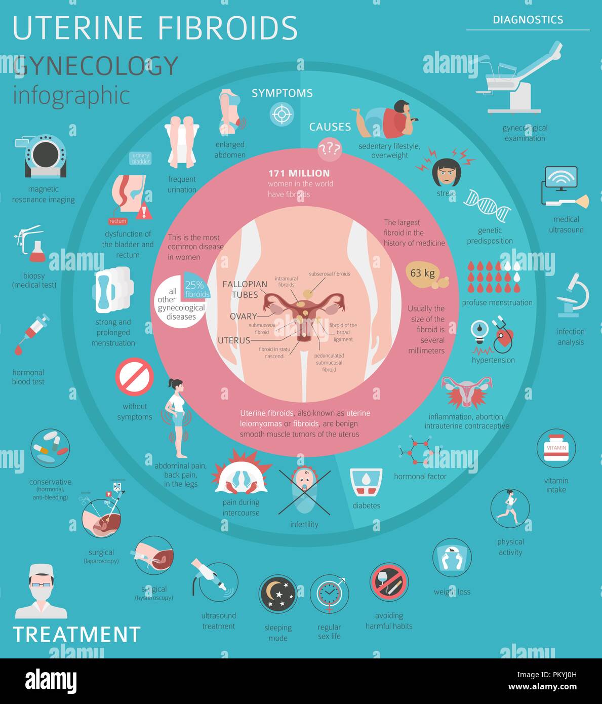 Uterine fibroids. Ginecological medical desease in women infographic. Vector illustration Stock Vector