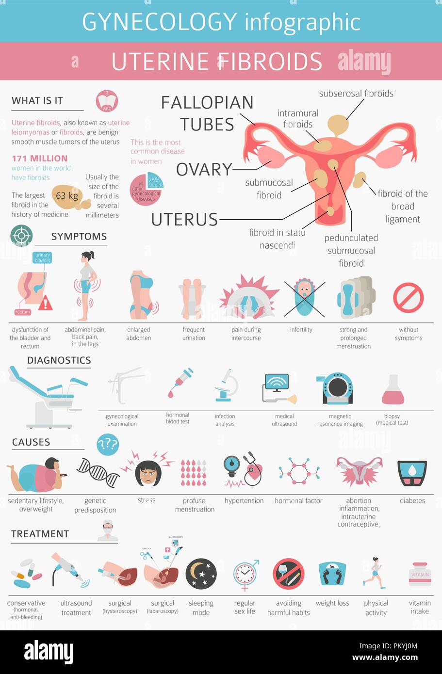 Uterine fibroids. Ginecological medical desease in women infographic. Vector illustration Stock Vector