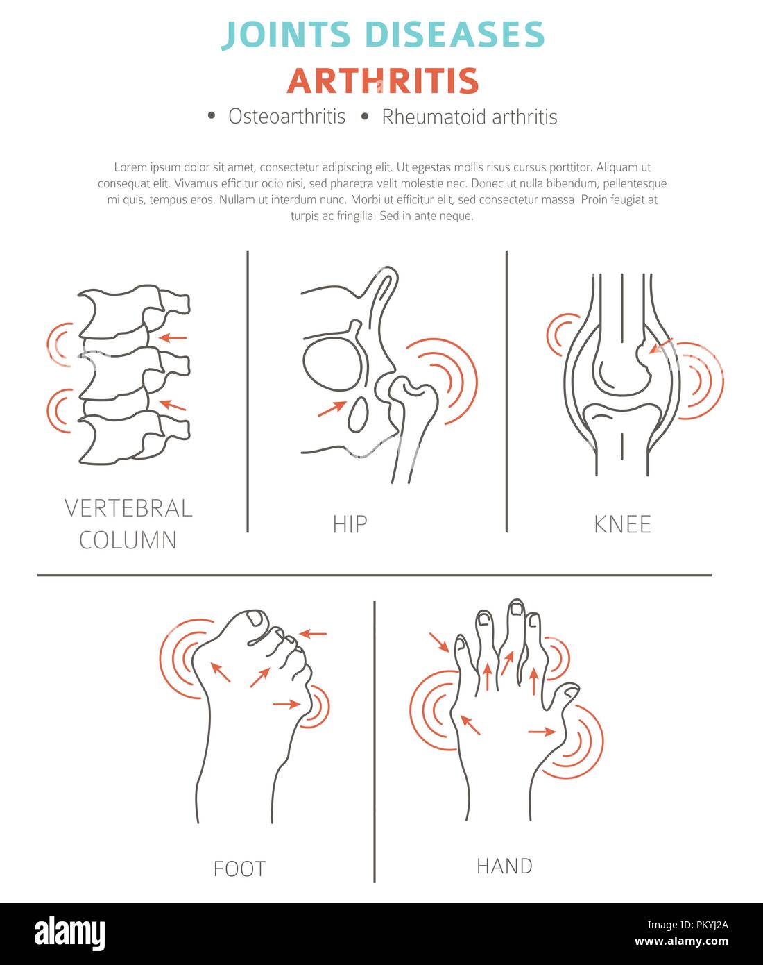 Joints diseases. Arthritis symptoms, treatment icon set. Medical