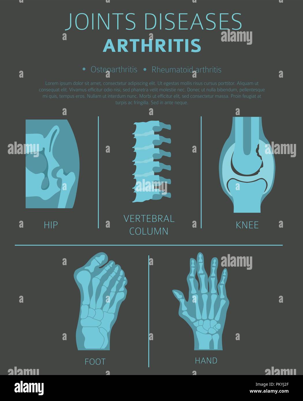 Joints diseases. Arthritis symptoms, treatment icon set. Medical