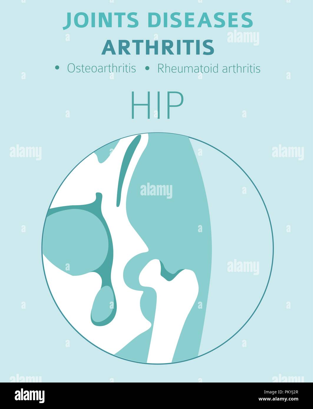 Joints diseases. Arthritis symptoms, treatment icon set. Medical