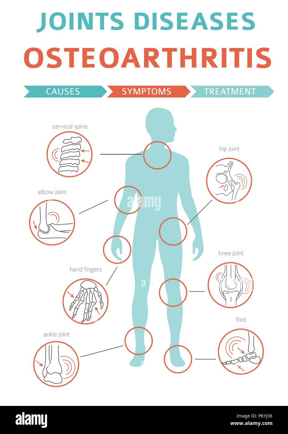 Joints diseases. Arthritis, osteoarthritis symptoms, treatment icon set