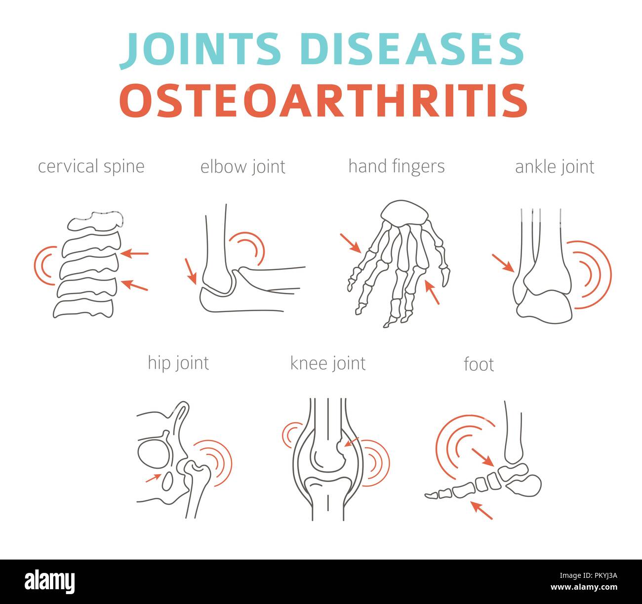 Joints diseases. Arthritis, osteoarthritis symptoms, treatment icon set