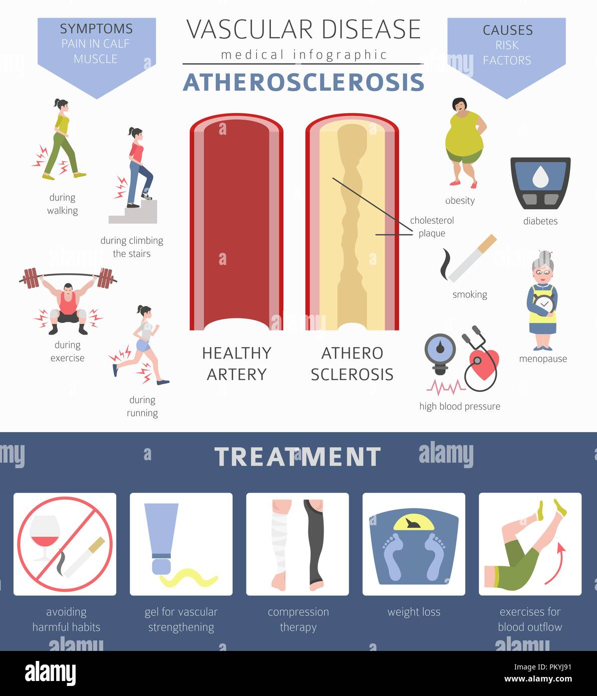Vascular diseases. Atherosclerosis symptoms, treatment icon set. Medical infographic design. Vector illustration Stock Vector
