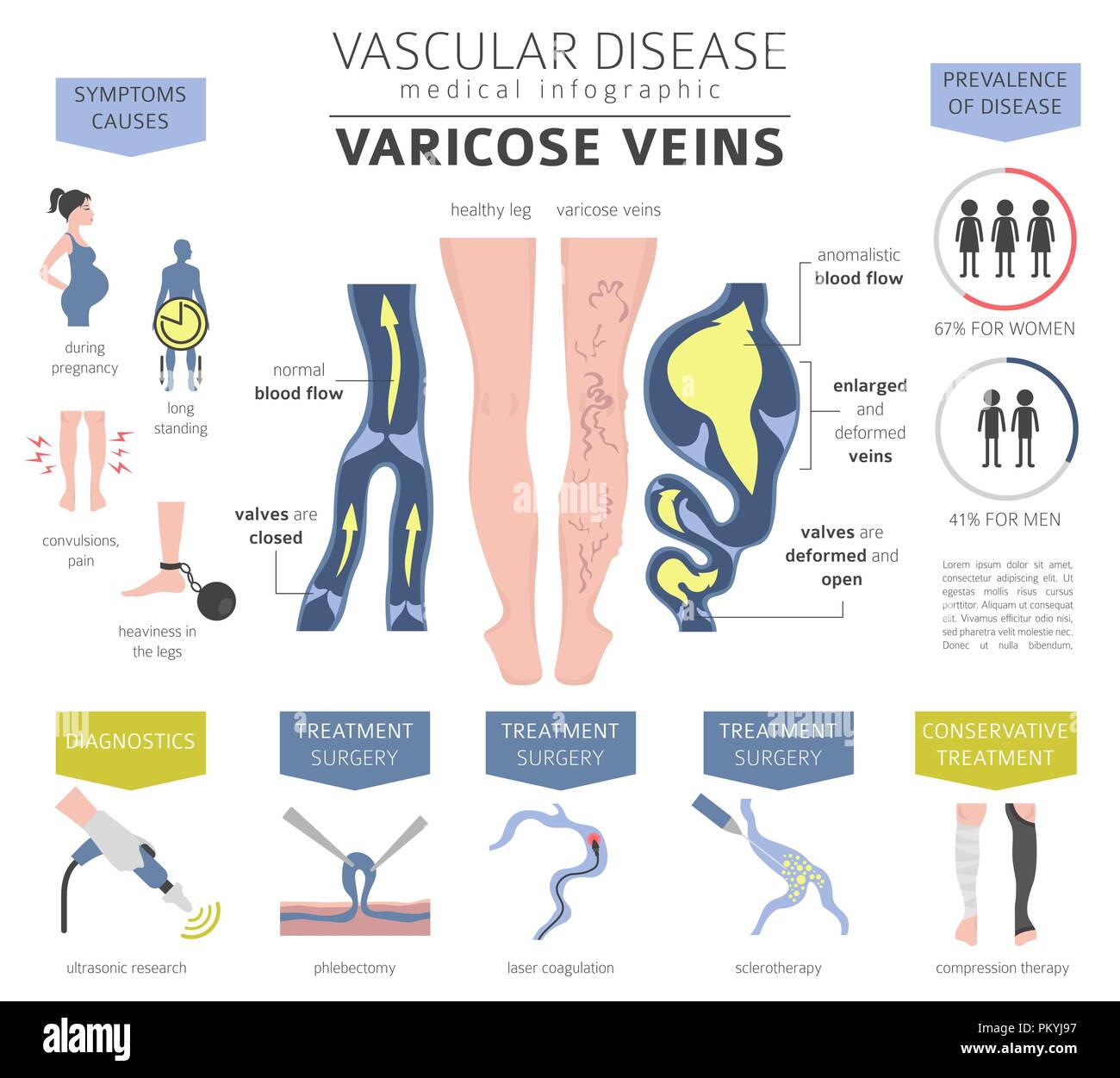 Vascular diseases. Varicose veins symptoms, treatment icon set. Medical infographic design. Vector illustration Stock Vector