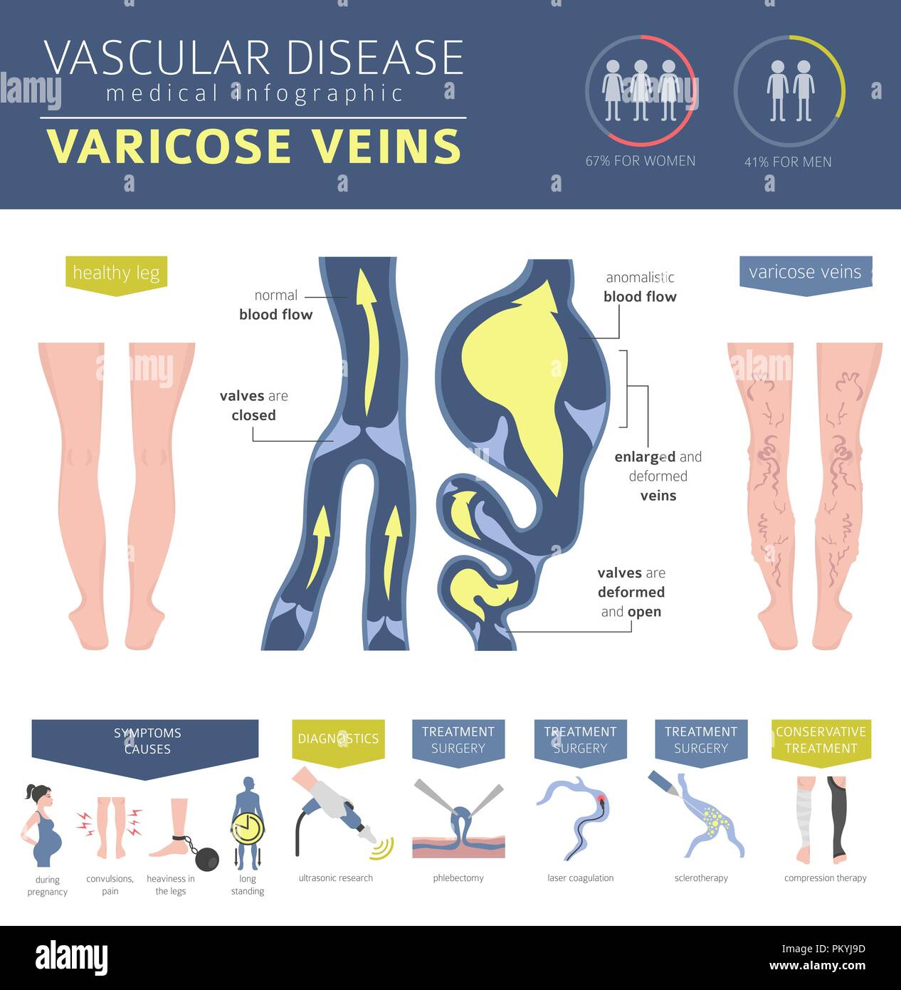 Vascular diseases. Varicose veins symptoms, treatment icon set. Medical infographic design. Vector illustration Stock Vector