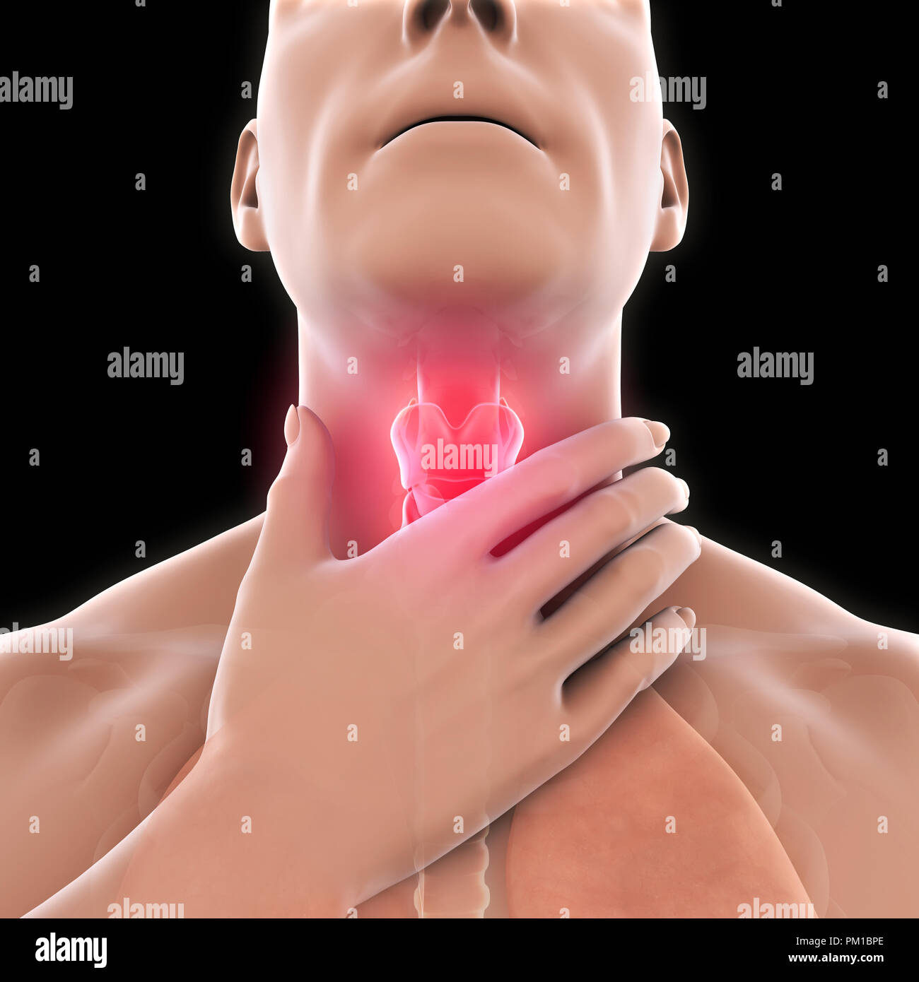 Inflammation of the larynx hires stock photography and images Alamy