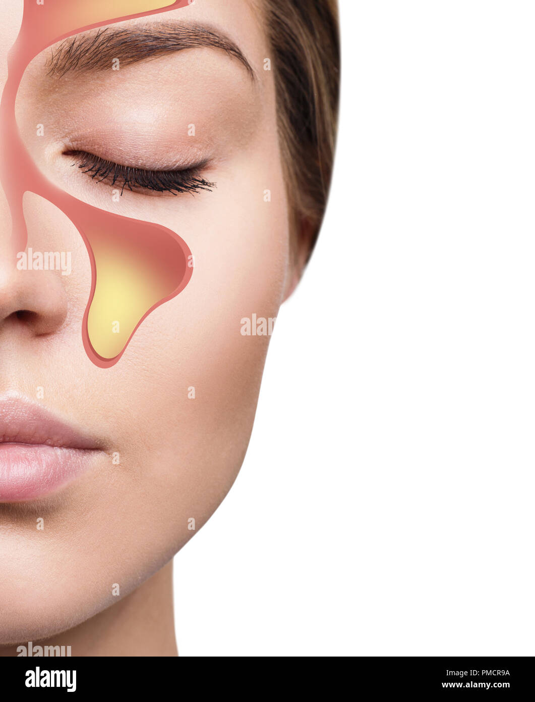 Female face shows nasal sinus with cold over white background. Stock Photo