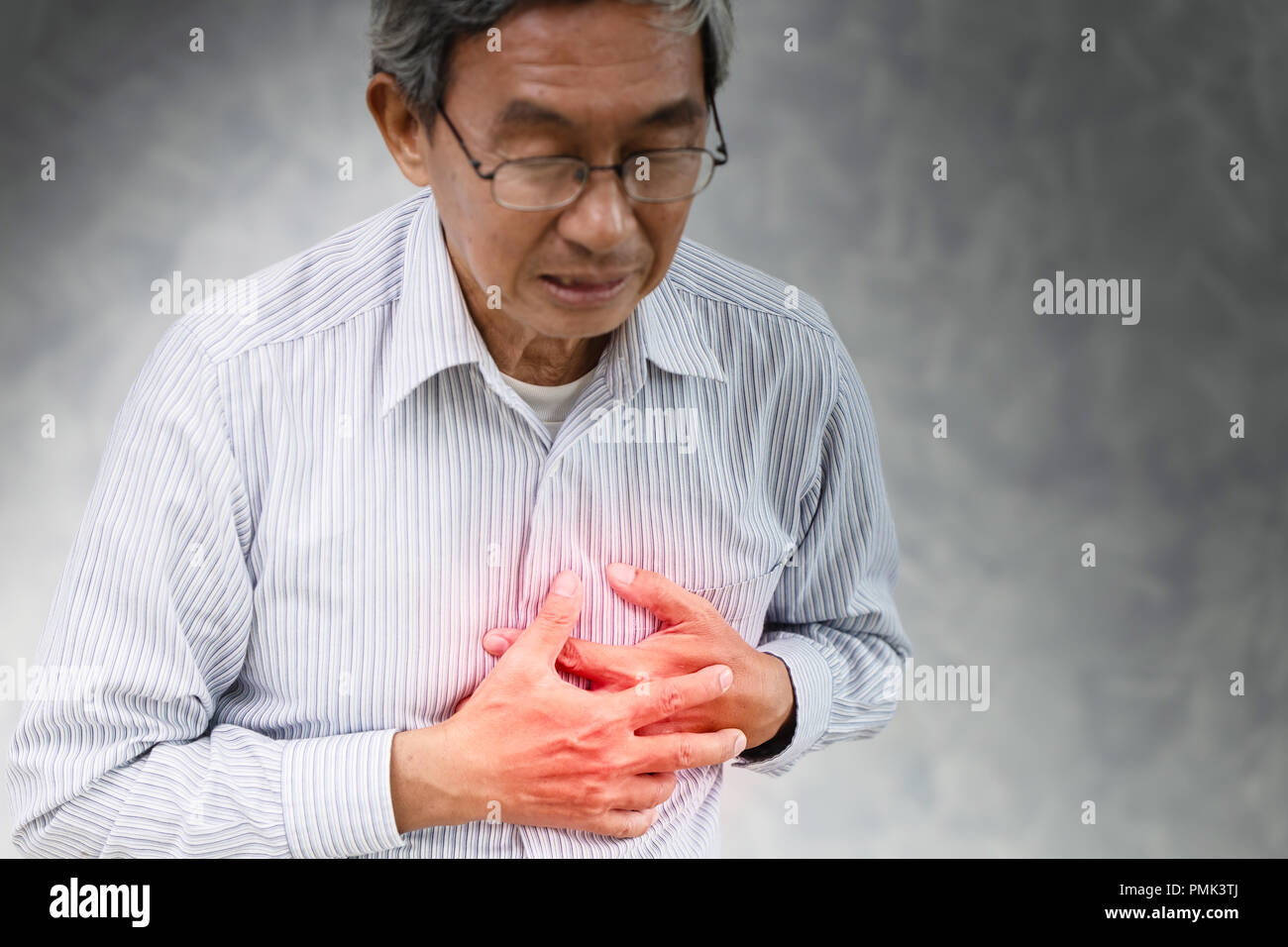 Senior stroke heart attack painful at chest Angina syndrome. Stock Photo