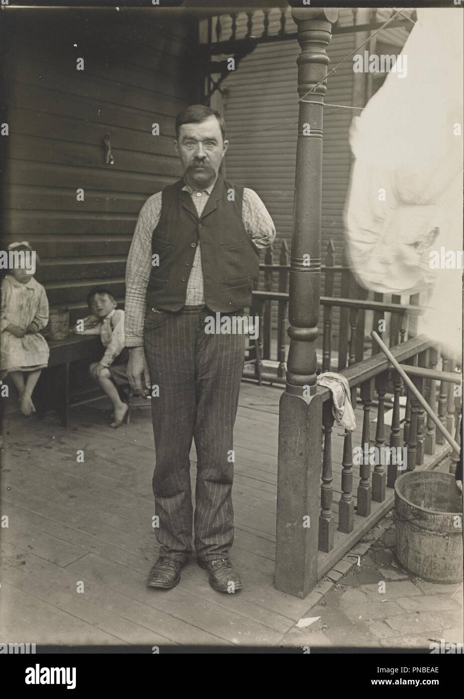 Man with amputated arm. Date/Period: 1905/1915. Gelatin silver print. Width: 12.7 cm. Height: 17.78 cm (sheet). Author: Lewis Hine. Stock Photo