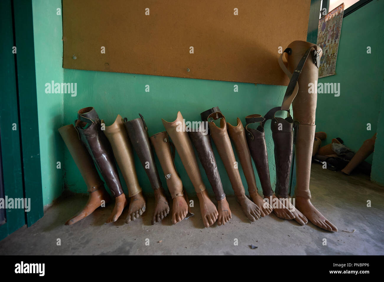 Legs in the prosthetics department of the Mother of Mercy Hospital in Gidel. A village in the Nuba Mountains of Sudan that is controlled by the Sudan People's Liberation Movement-North and it is frequently attacked by the military of Sudan. Stock Photo