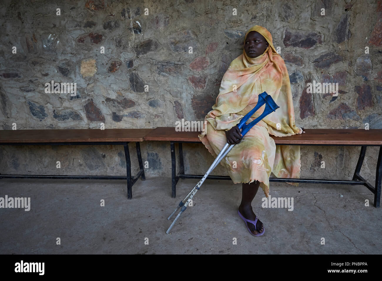A woman who had a leg amputated seen waiting from outside the prosthetics department of the Mother of Mercy Hospital in Gidel. A village in the Nuba Mountains of Sudan that is controlled by the Sudan People's Liberation Movement-North and it is frequently attacked by the military of Sudan. Stock Photo