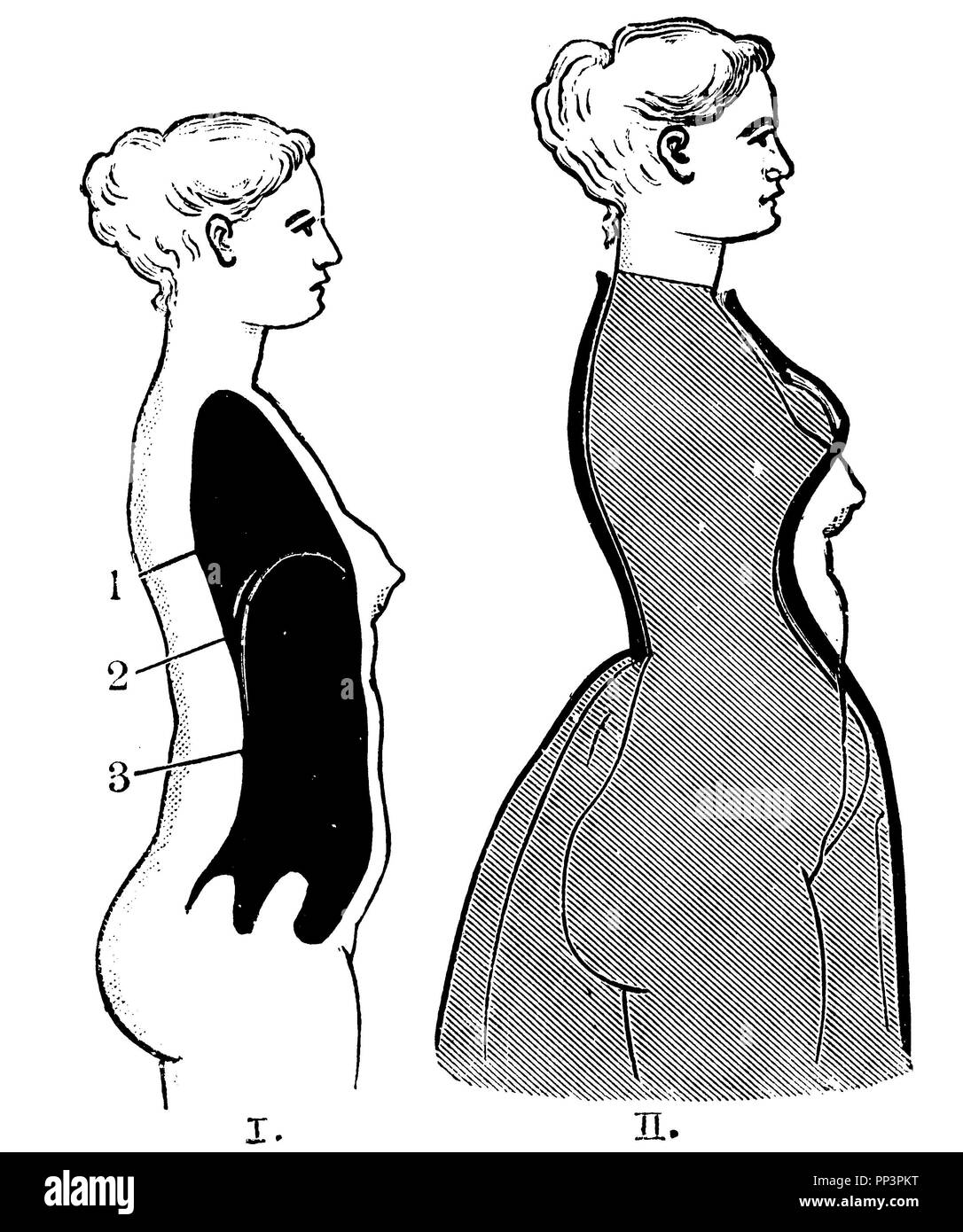 I. Female body without corset. II. Change of shape through the corset. After Dickinson. 1 chest cavity, 2 diaphragm 3 abdominal cavity,   1905 Stock Photo