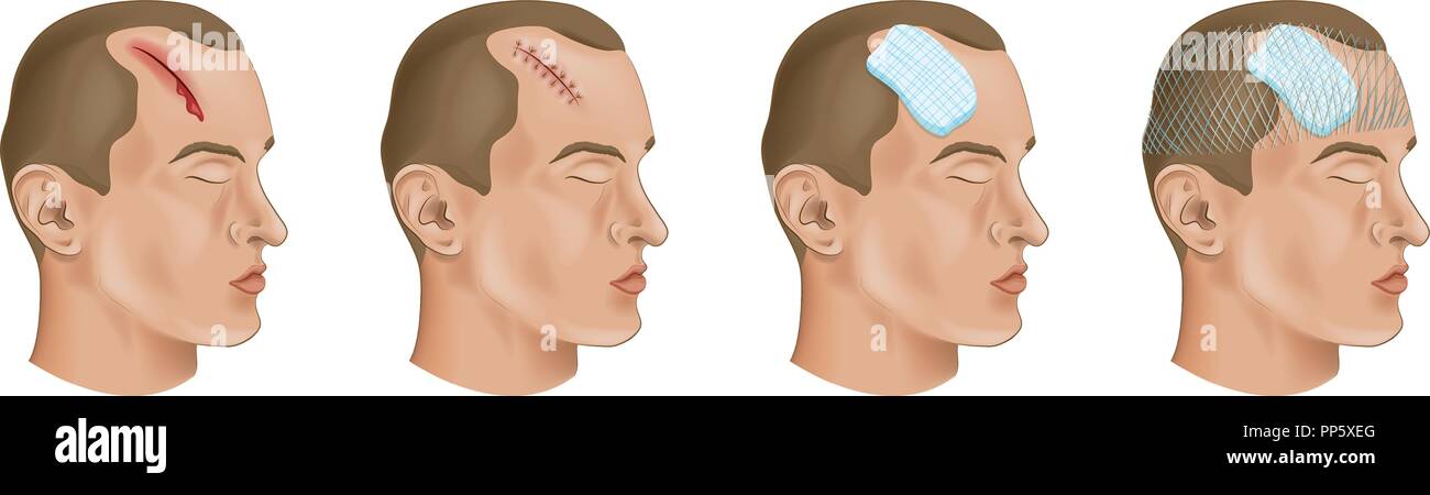 vector illustration of a medical bandage on a head Stock Vector