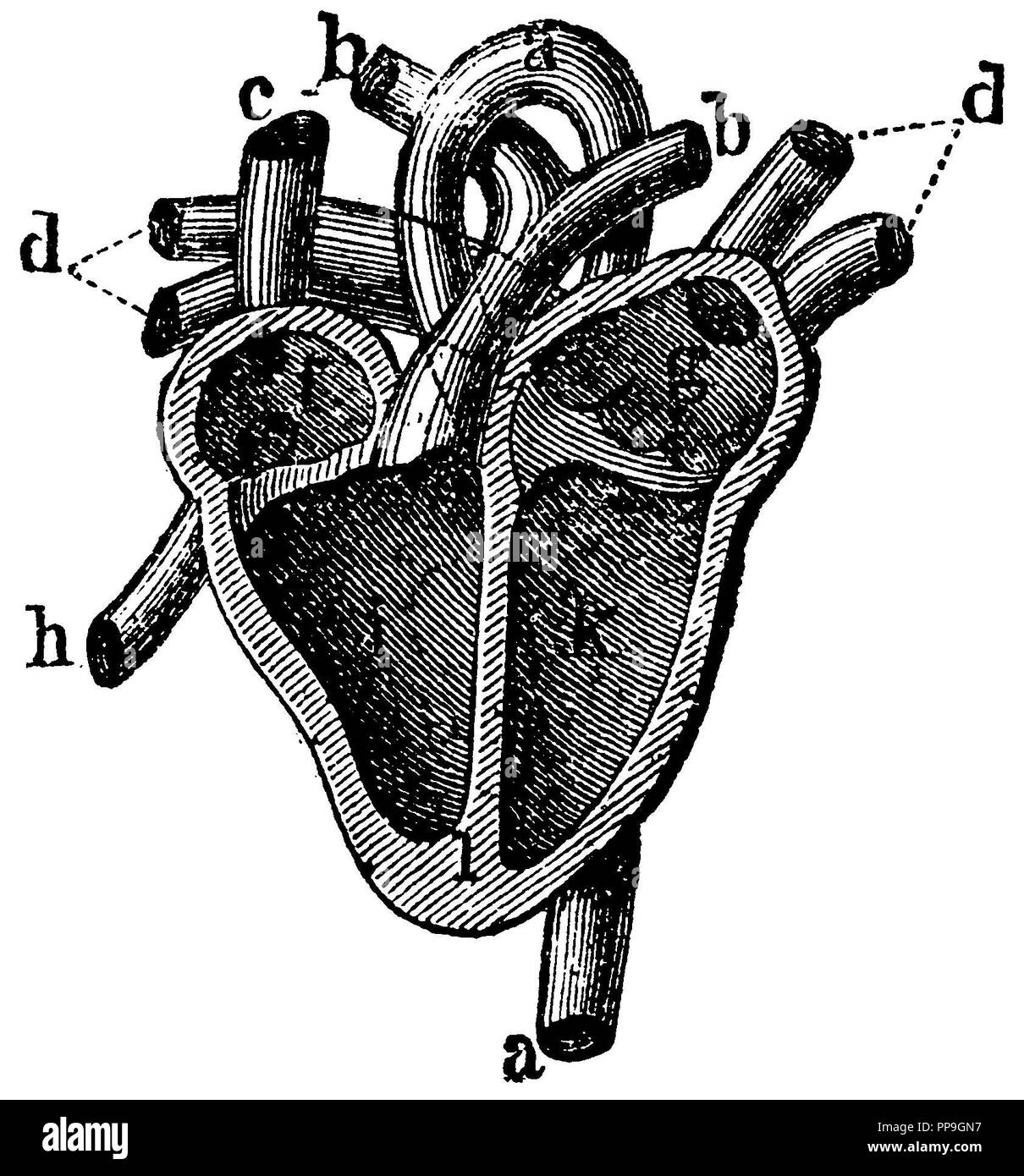 Human: section of the heart with the ascites a aorta, b pulmonary artery c superior vena cava d lunar veins f right anterior chamber g left anterior chamber h inferior vena cava i right ventricle k left ventricle l septum, anonym  1877 Stock Photo