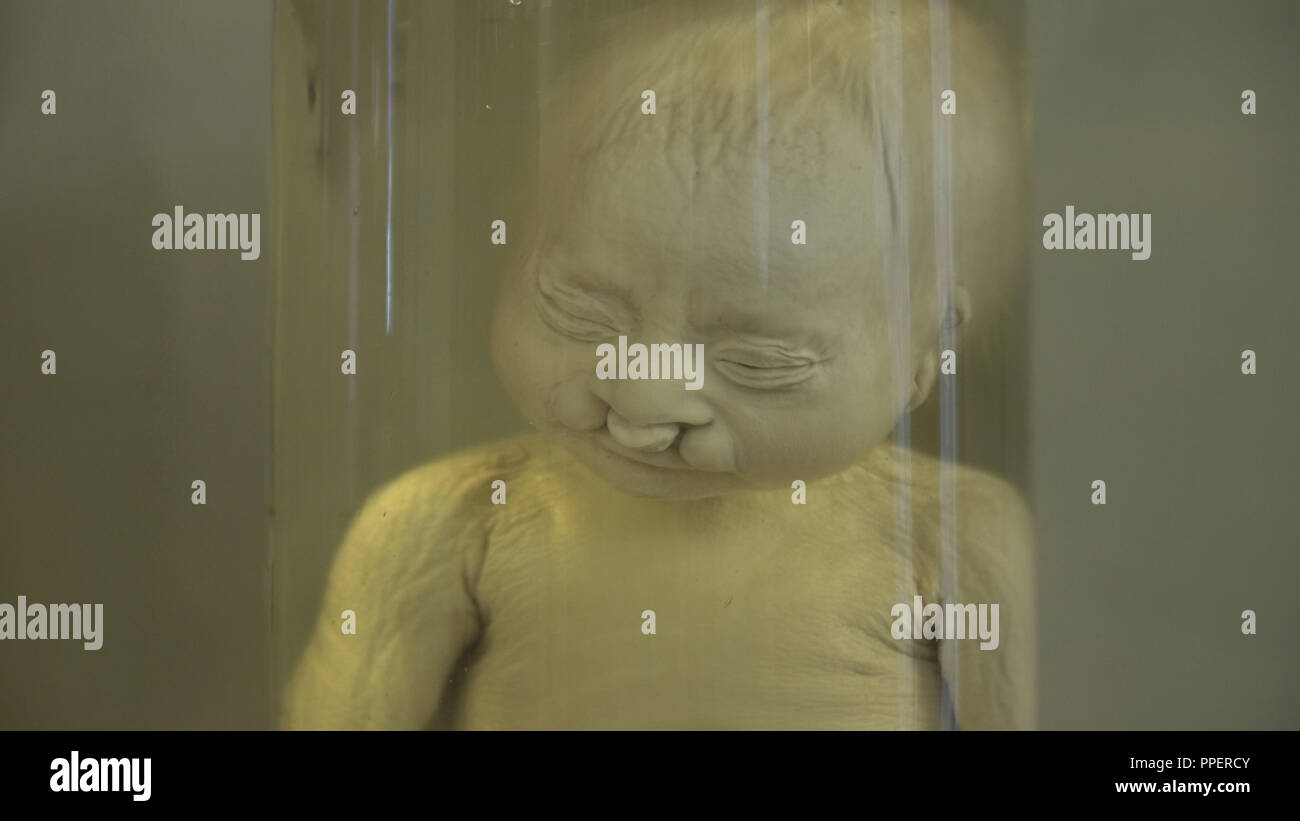 Preserved Specimen Jar High Resolution Stock Photography and Images Alamy