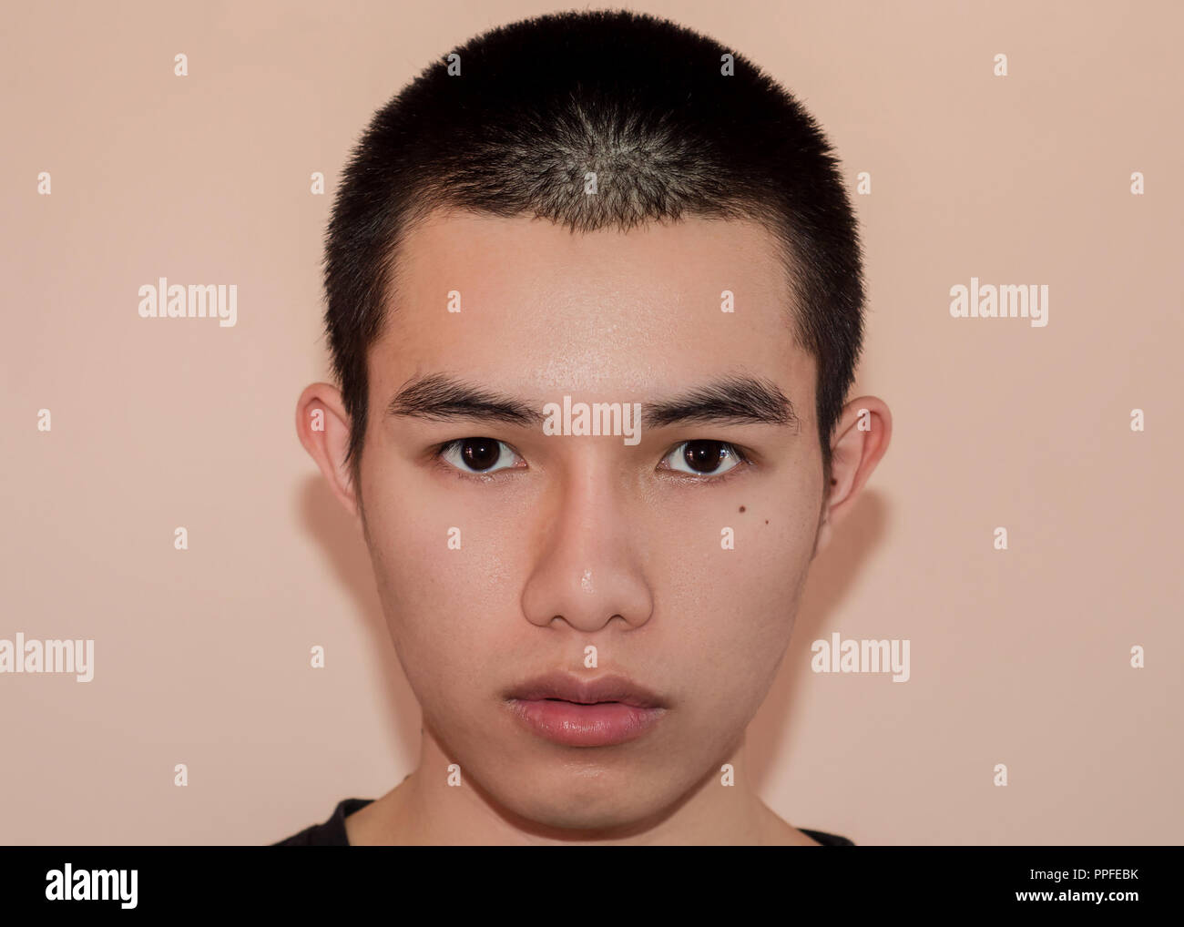 Young man with beautiful face after treatment from acne and pimple, After of face with out of scars and wrinkle by acne removal. Smooth skin by treatm Stock Photo