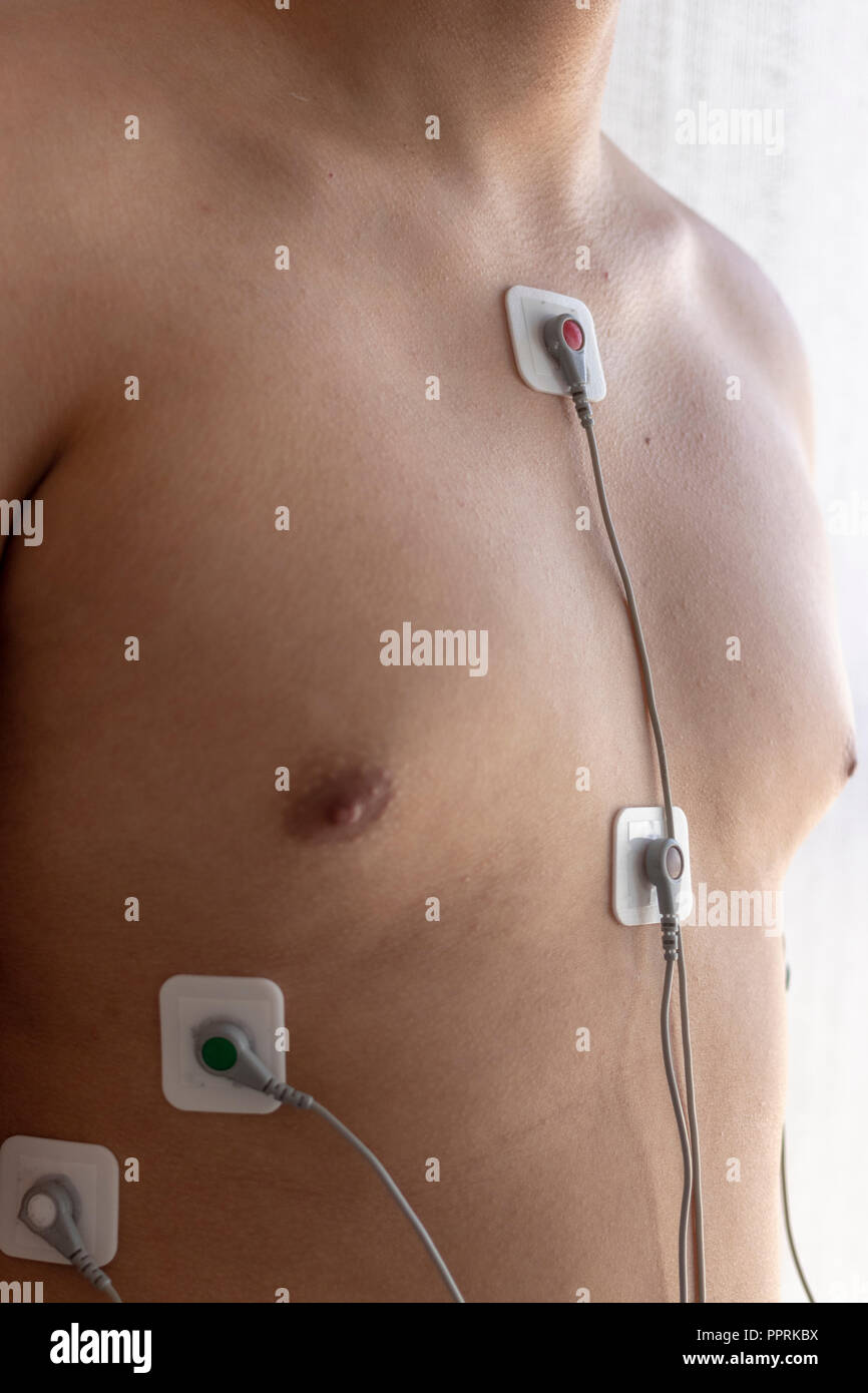 Patient with study of holter in his body Stock Photo